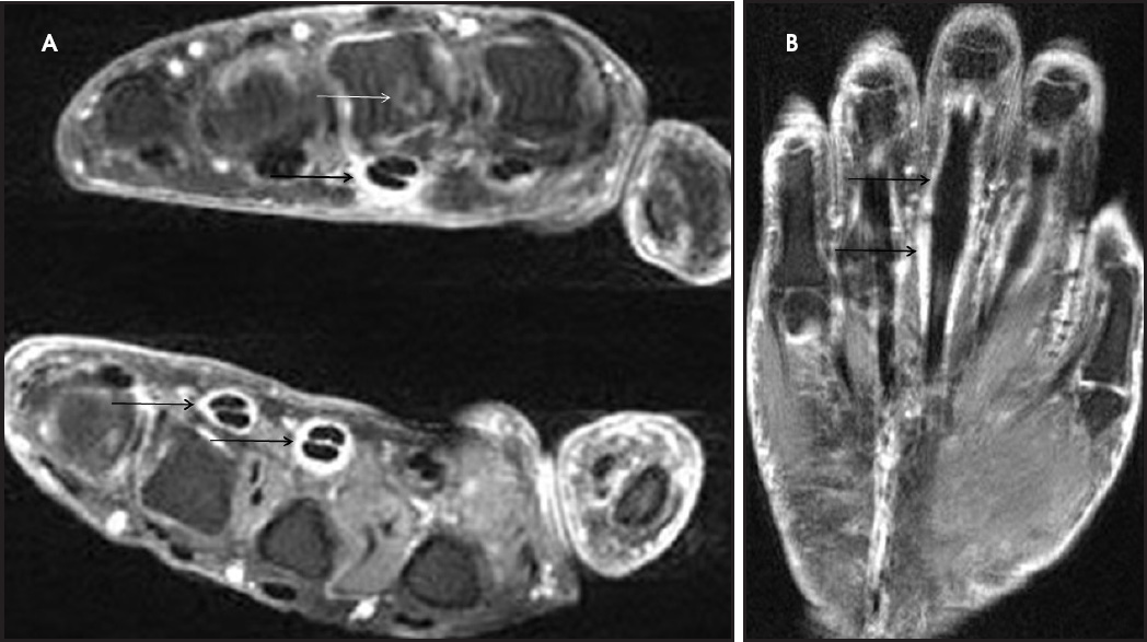 FIGURE 16.