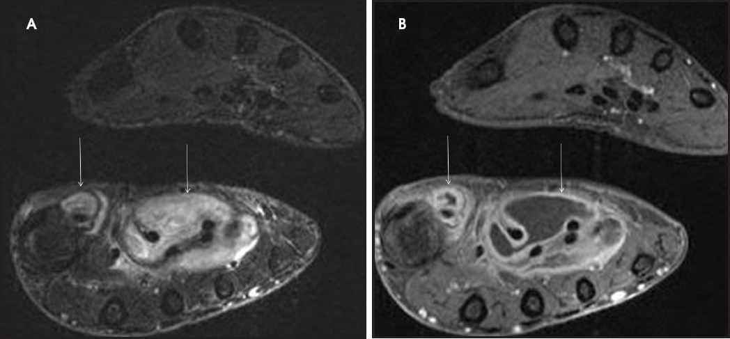 FIGURE 17.
