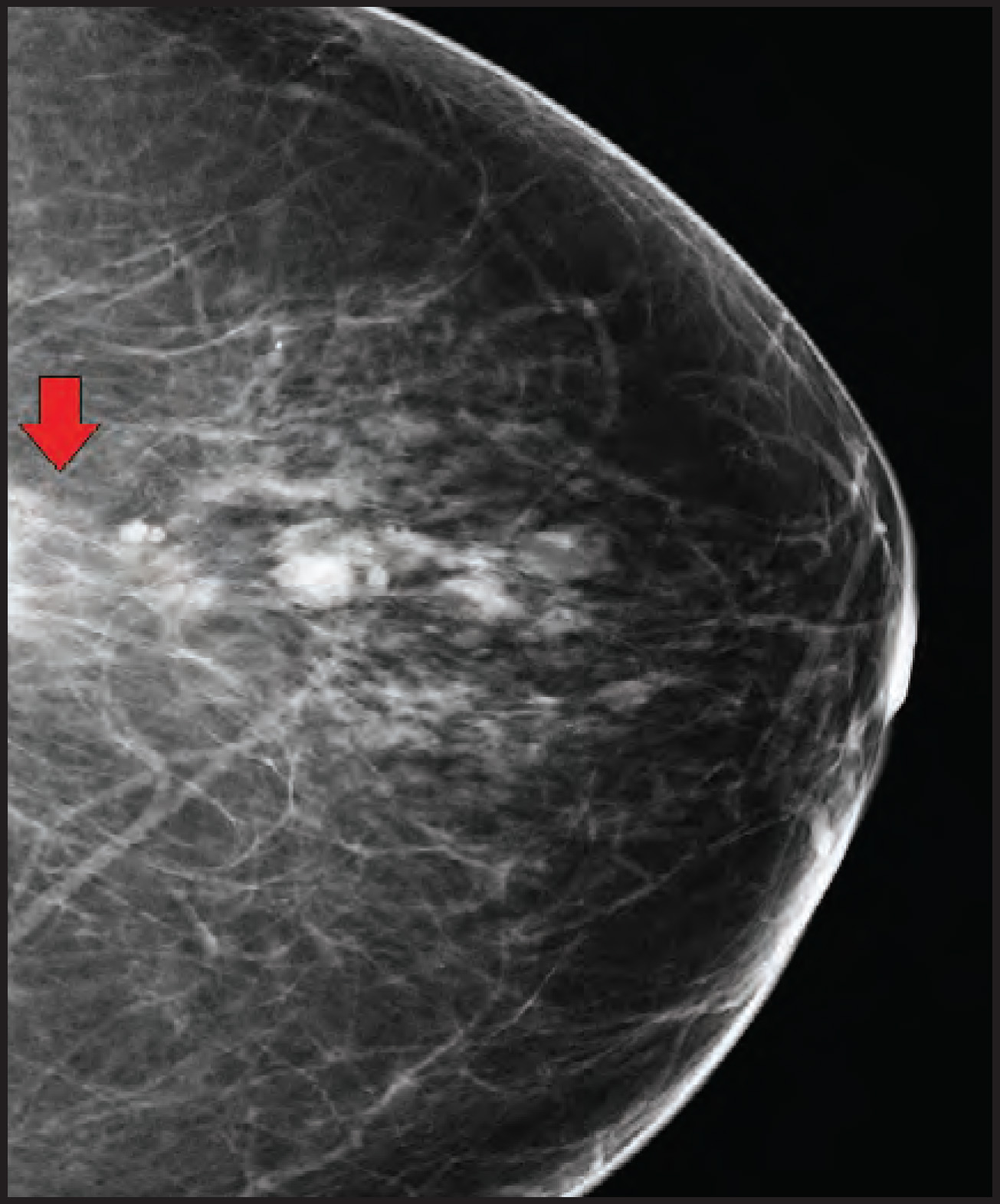 FIGURE 11.
