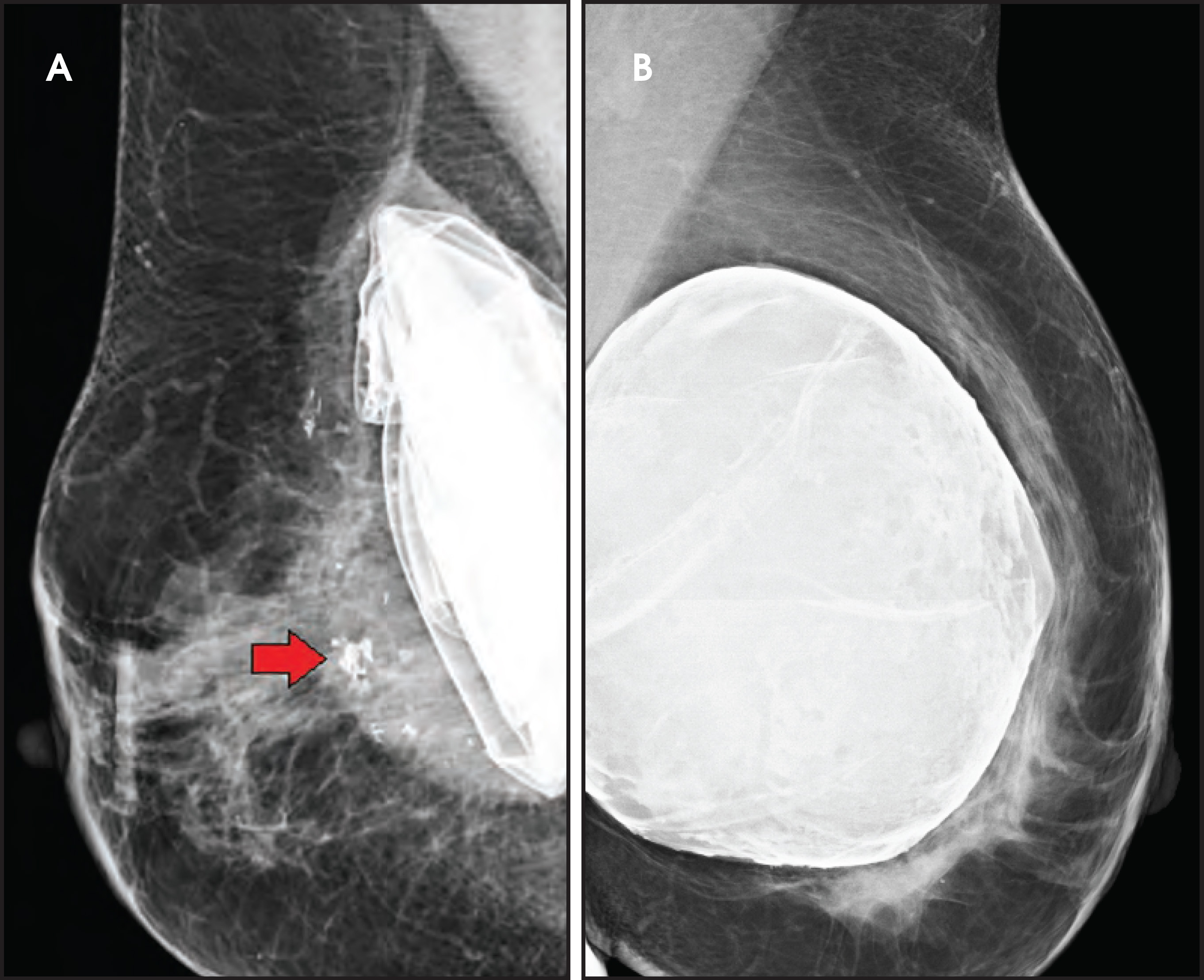 FIGURE 13.