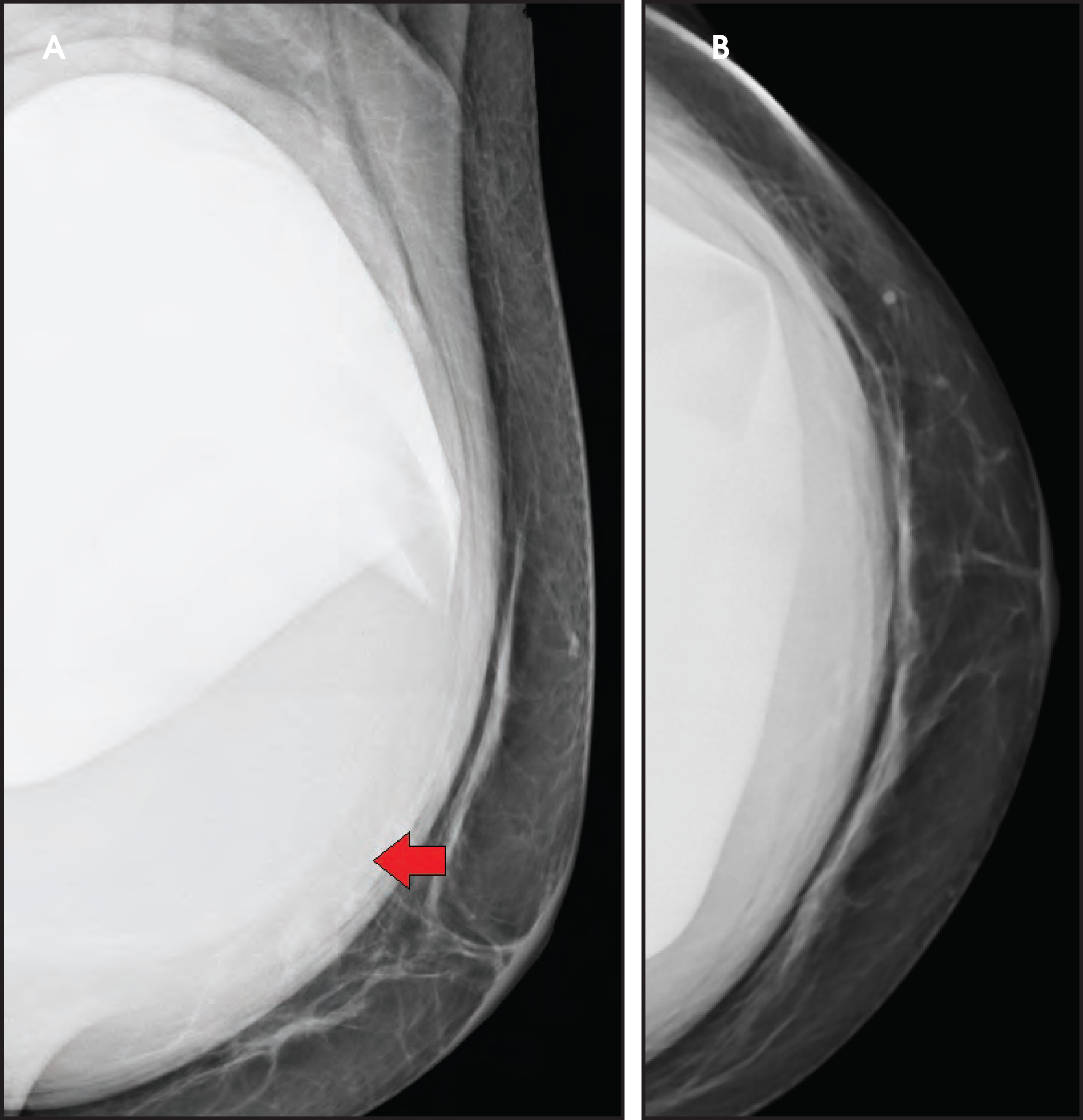 FIGURE 14.