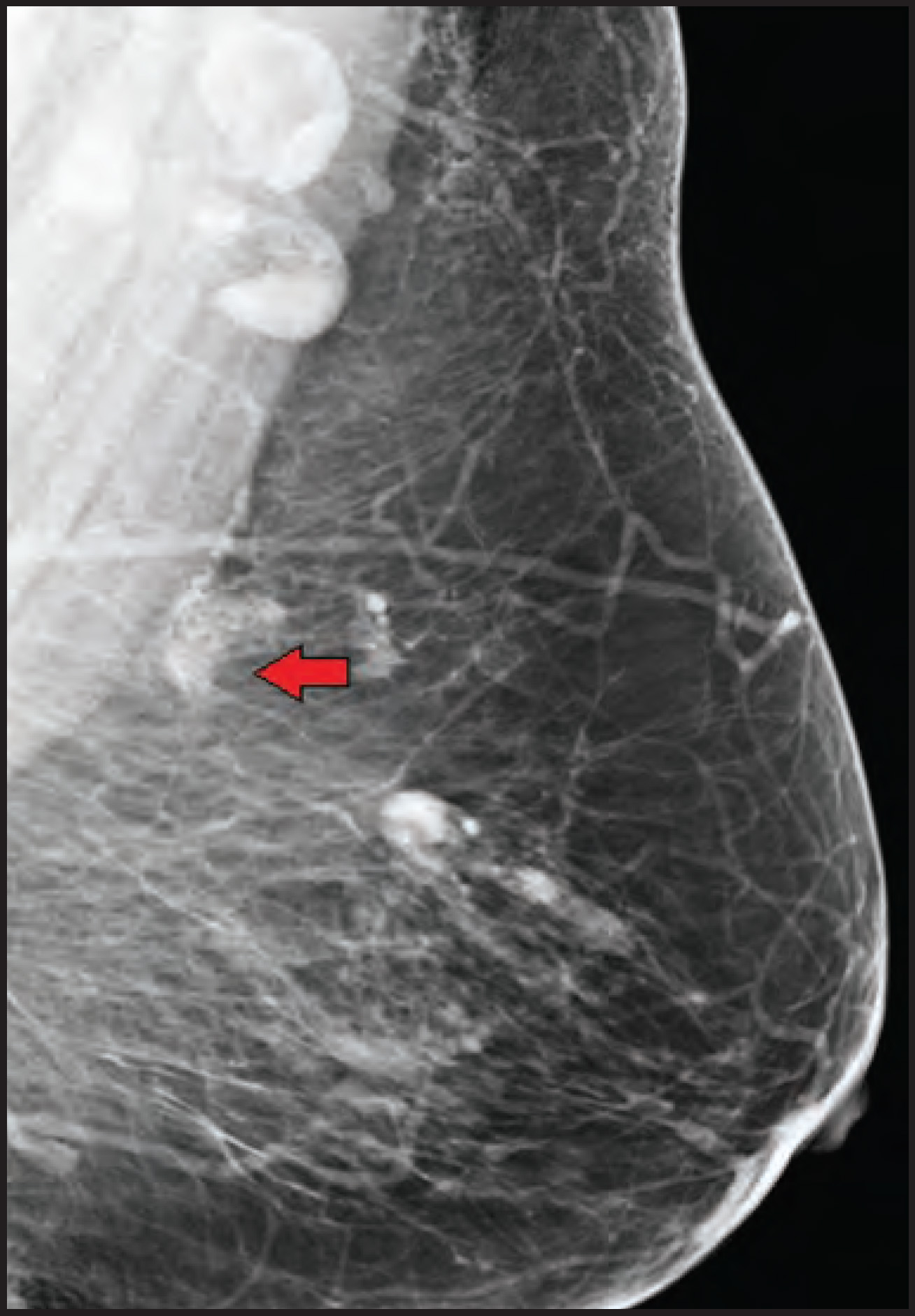 FIGURE 17.