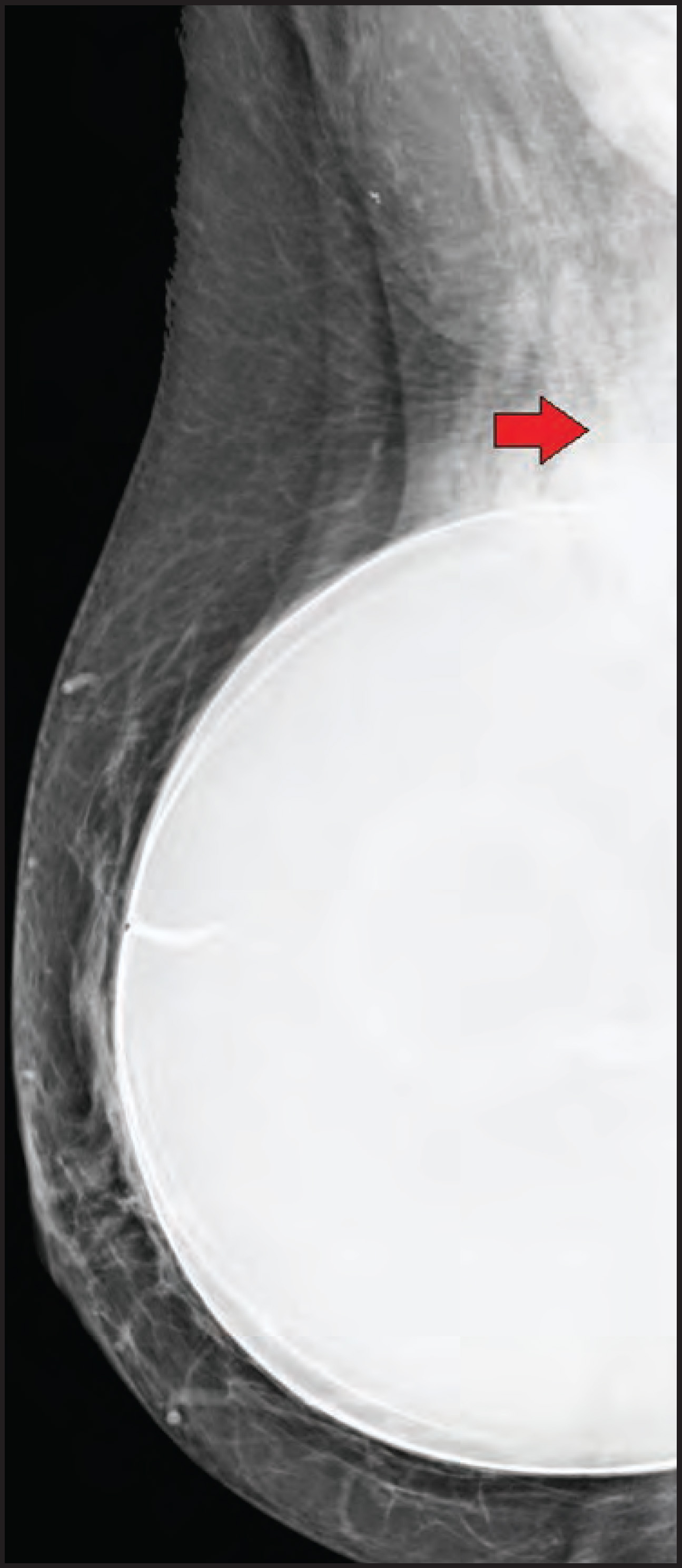 FIGURE 18.