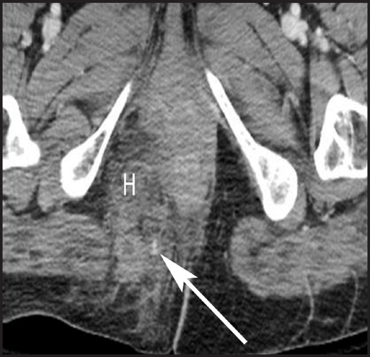 FIGURE 3.
