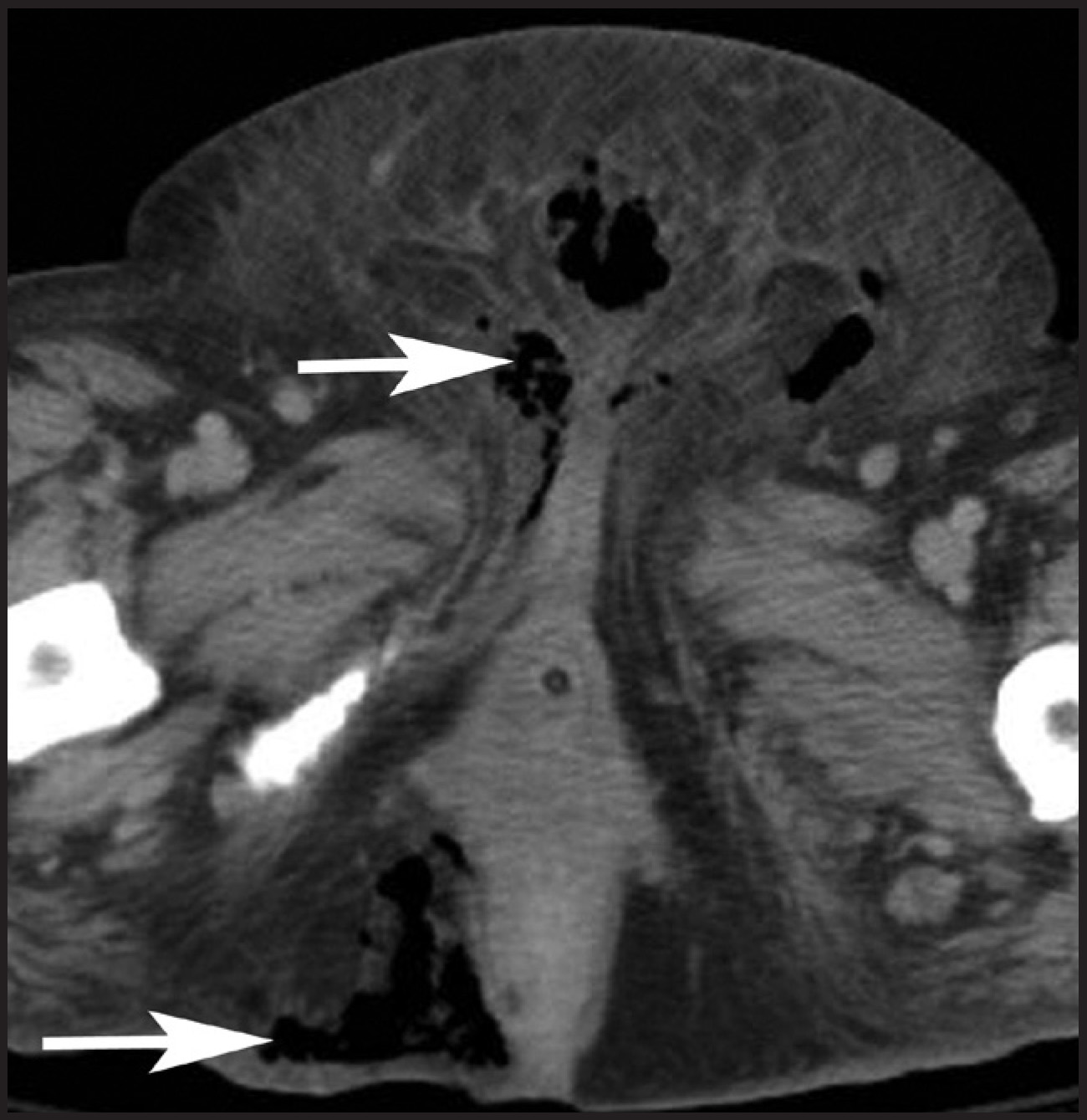 FIGURE 6.