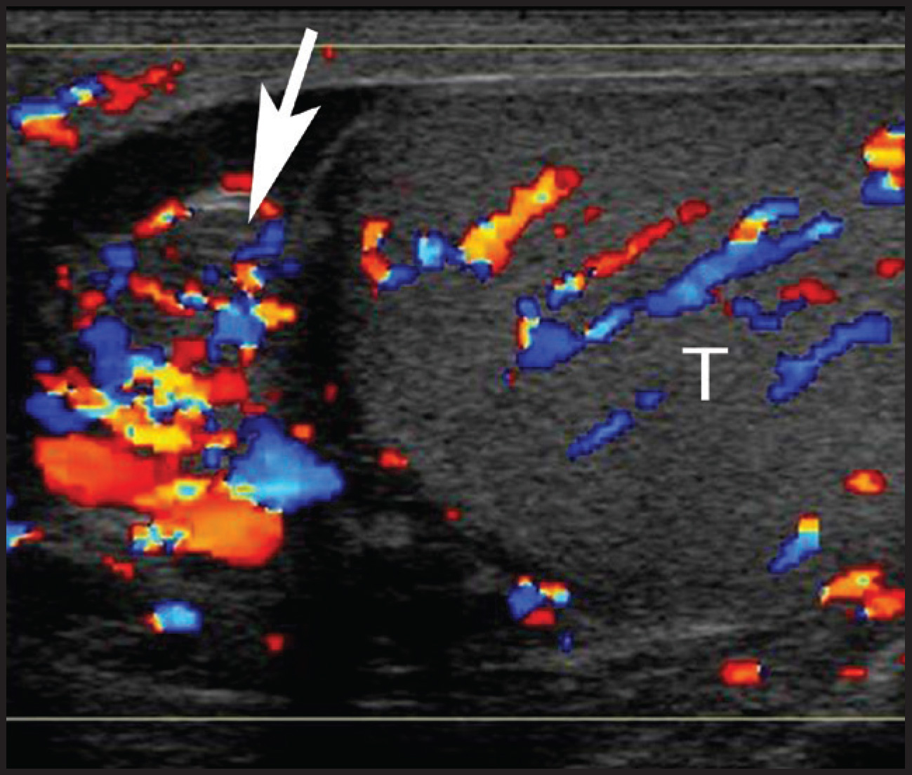 FIGURE 11.