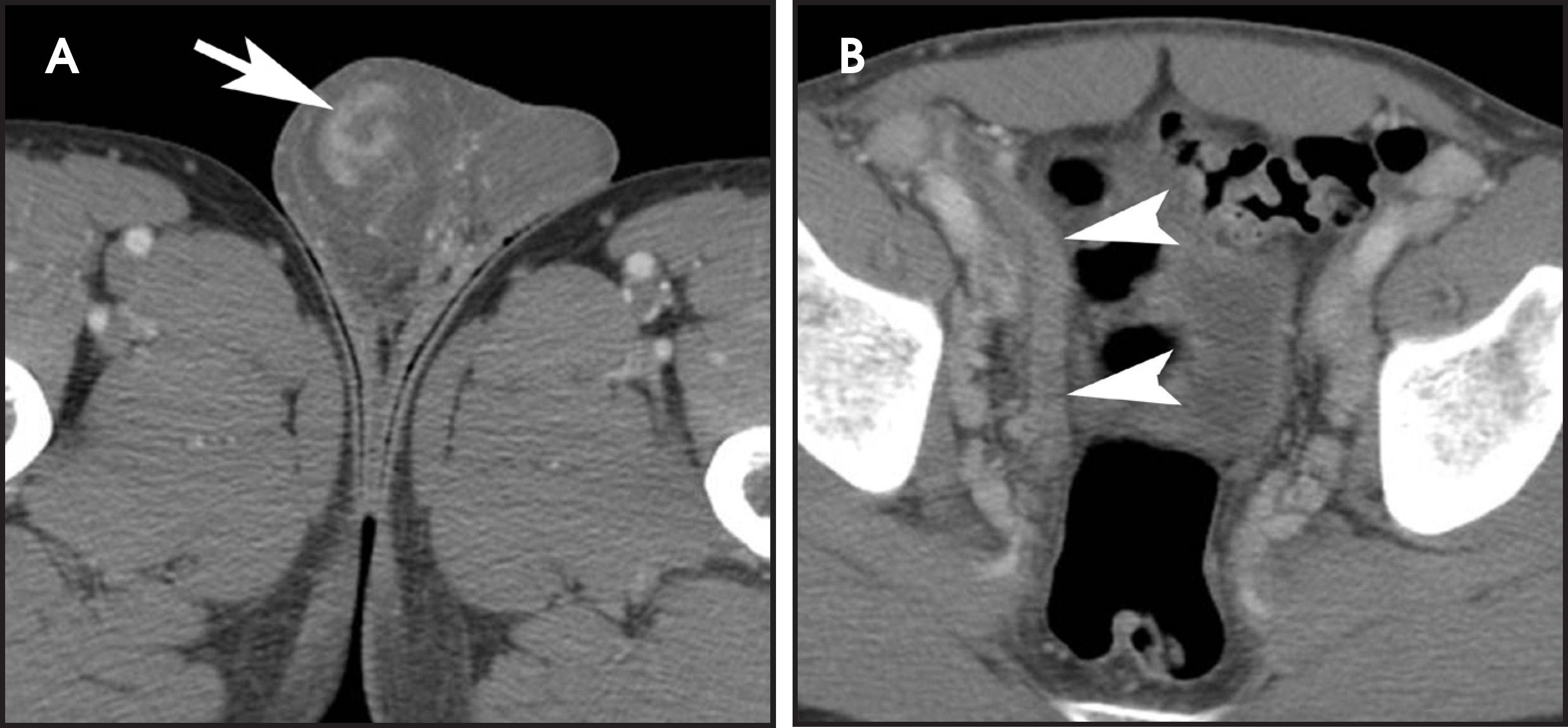 FIGURE 12.