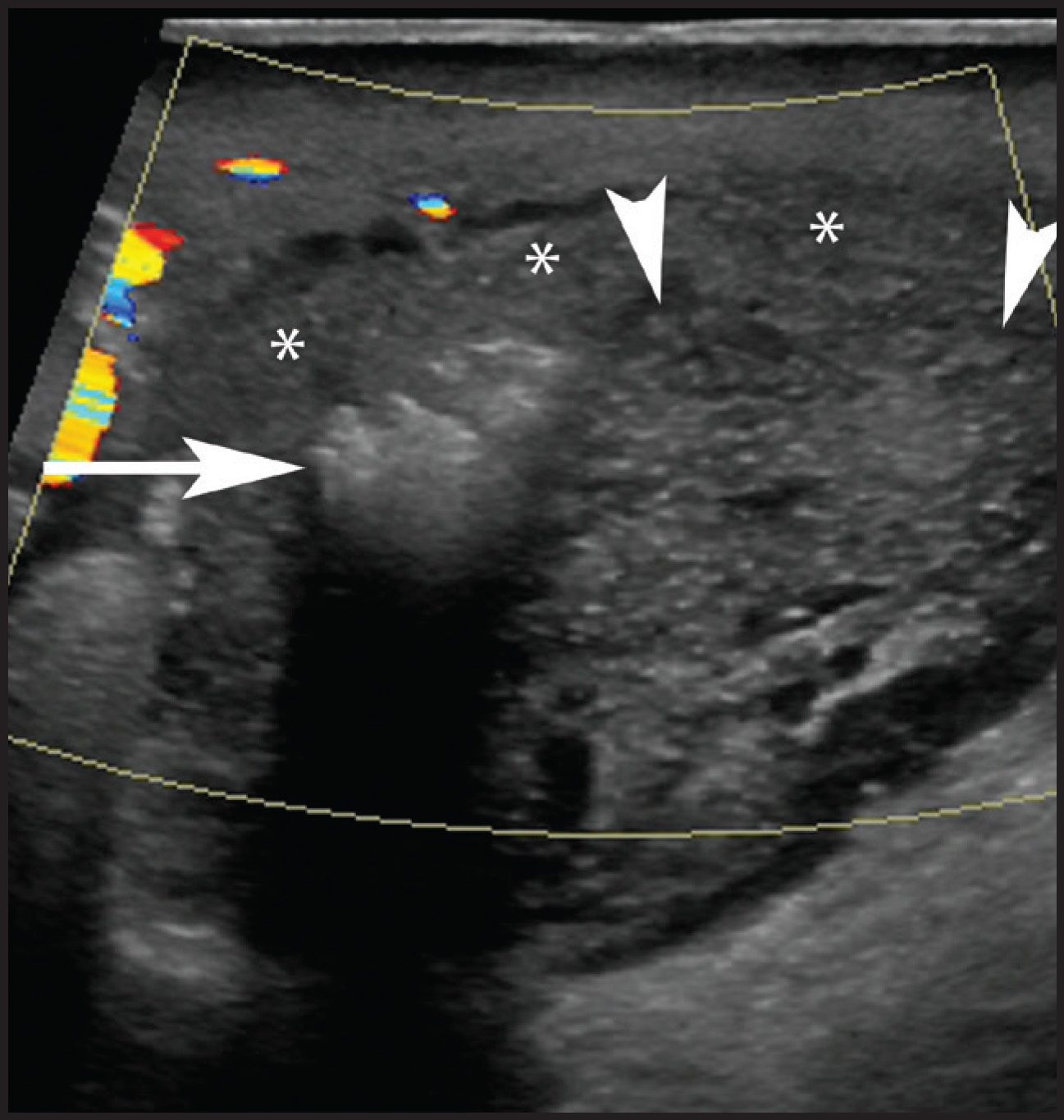 FIGURE 13.