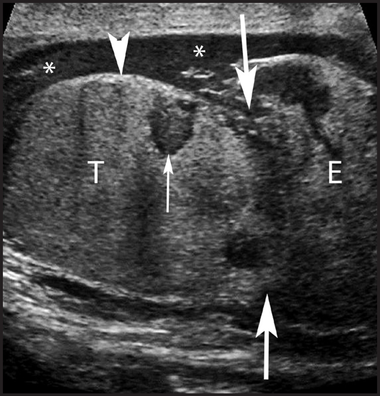 FIGURE 14.
