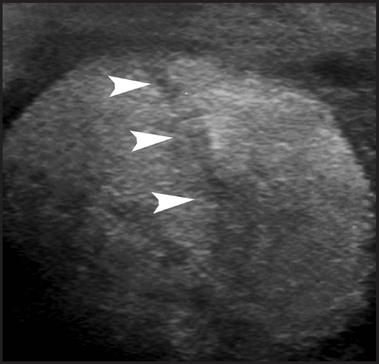 FIGURE 15.