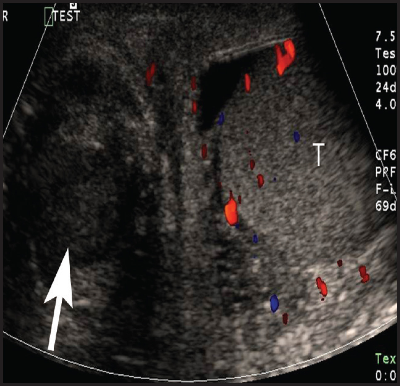 FIGURE 16.
