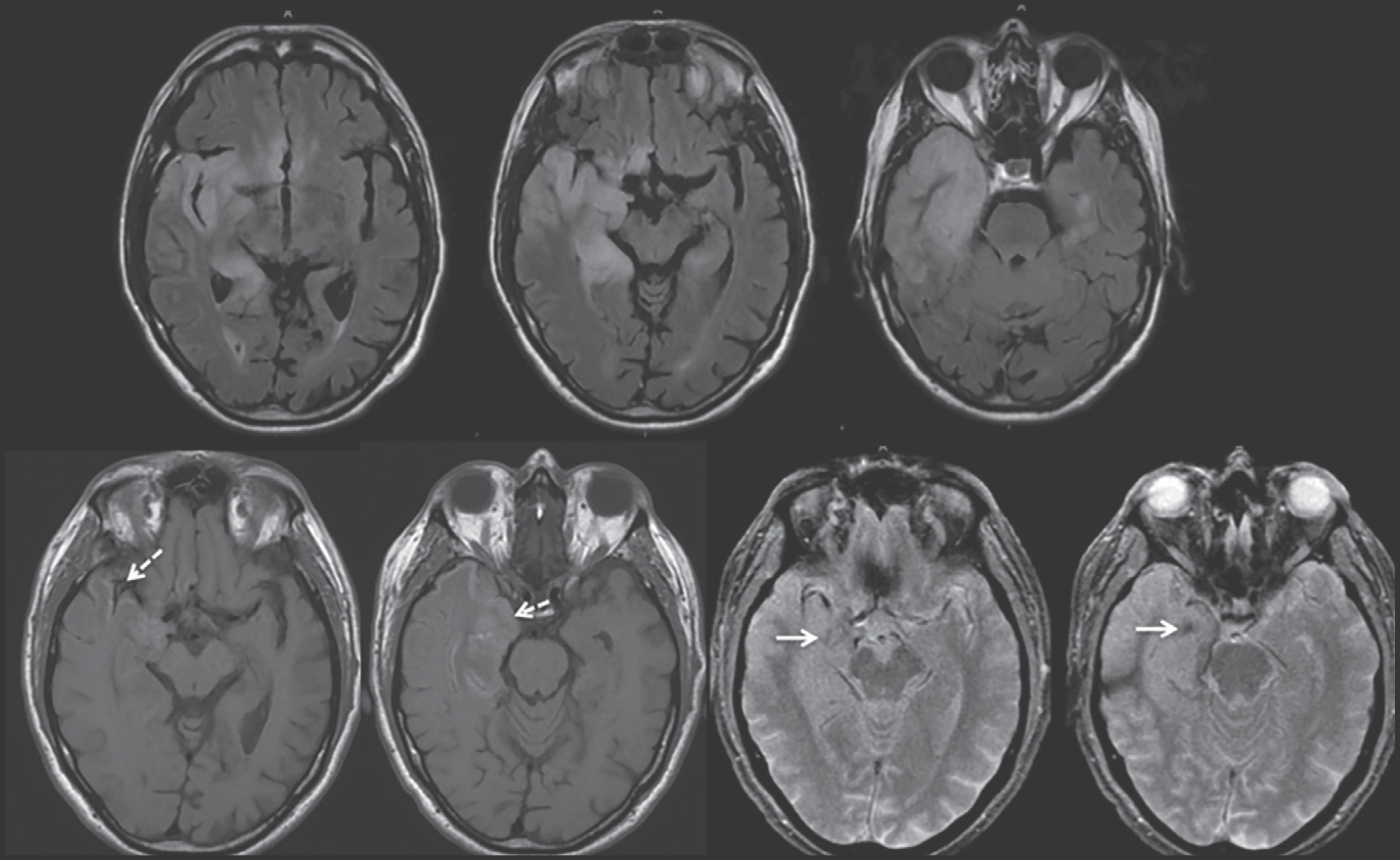 FIGURE 11.