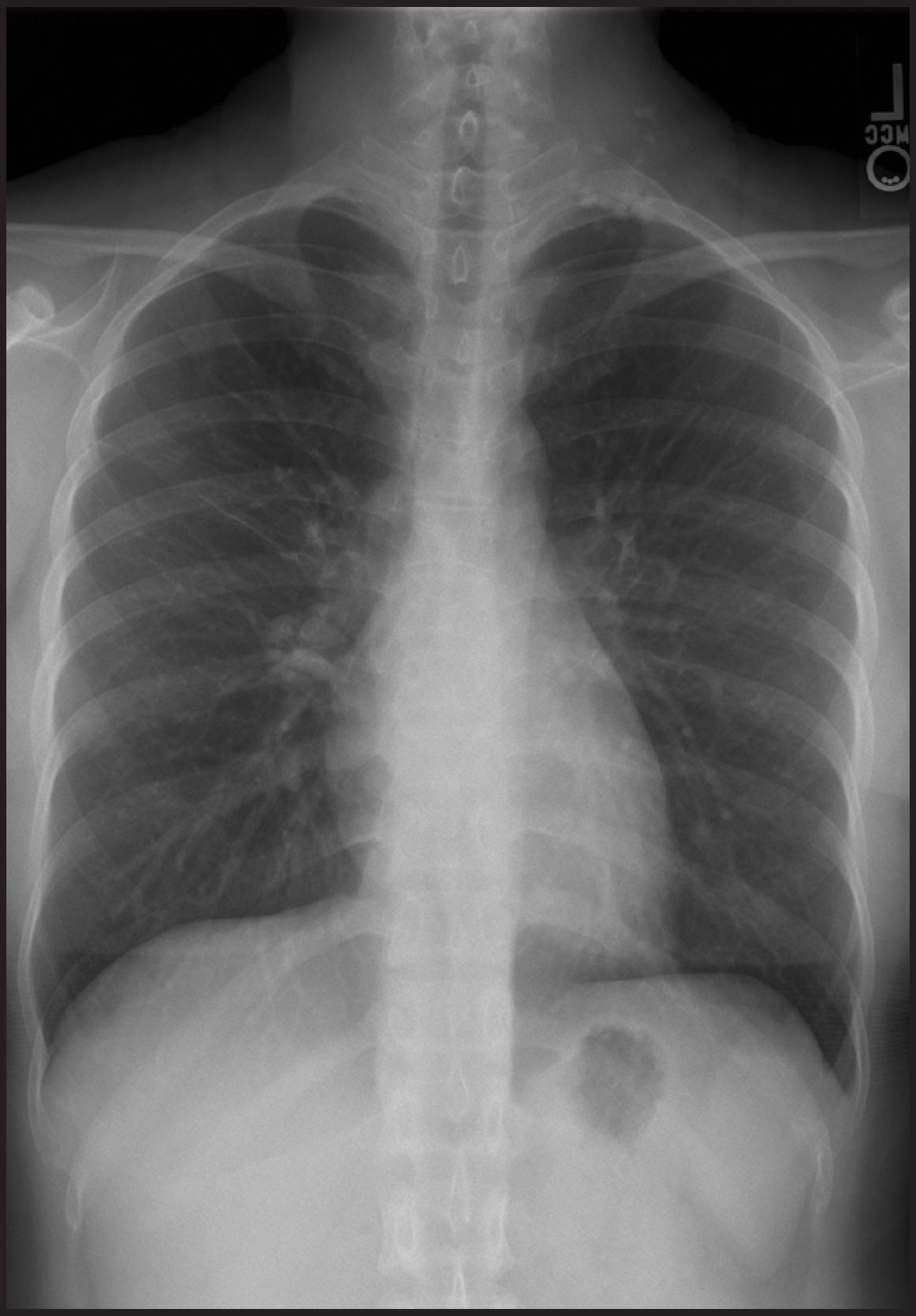 FIGURE 1