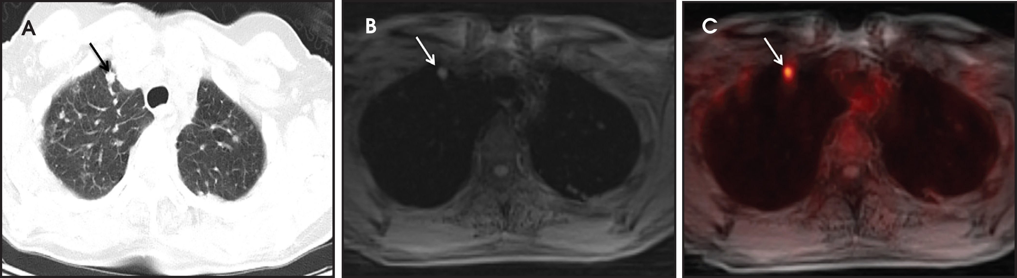 FIGURE 11.