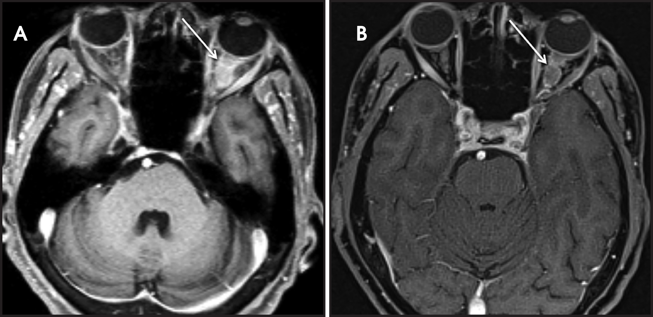 FIGURE 13.