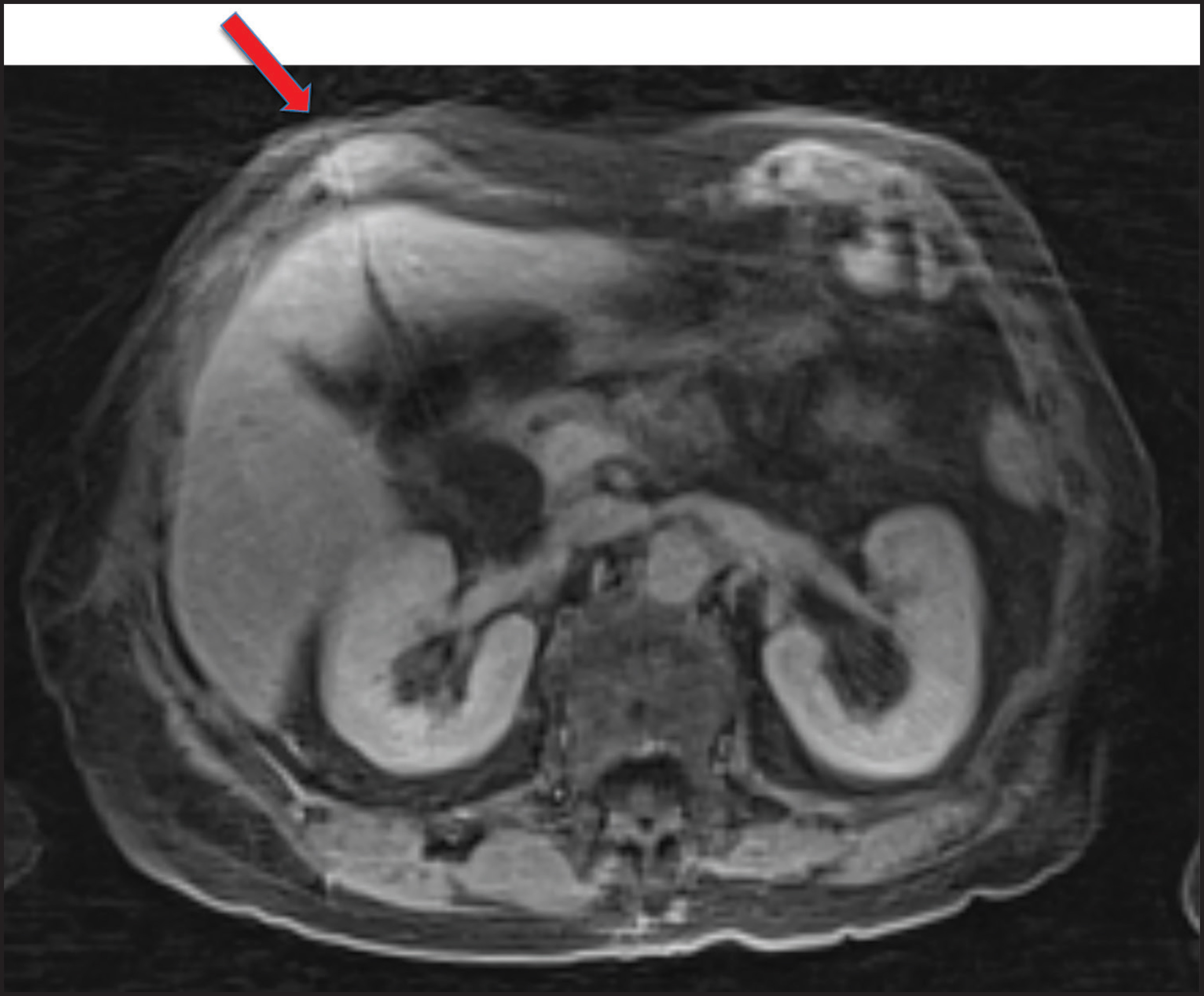 FIGURE 14.