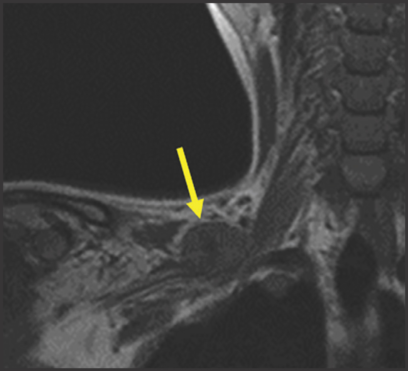 FIGURE 10.