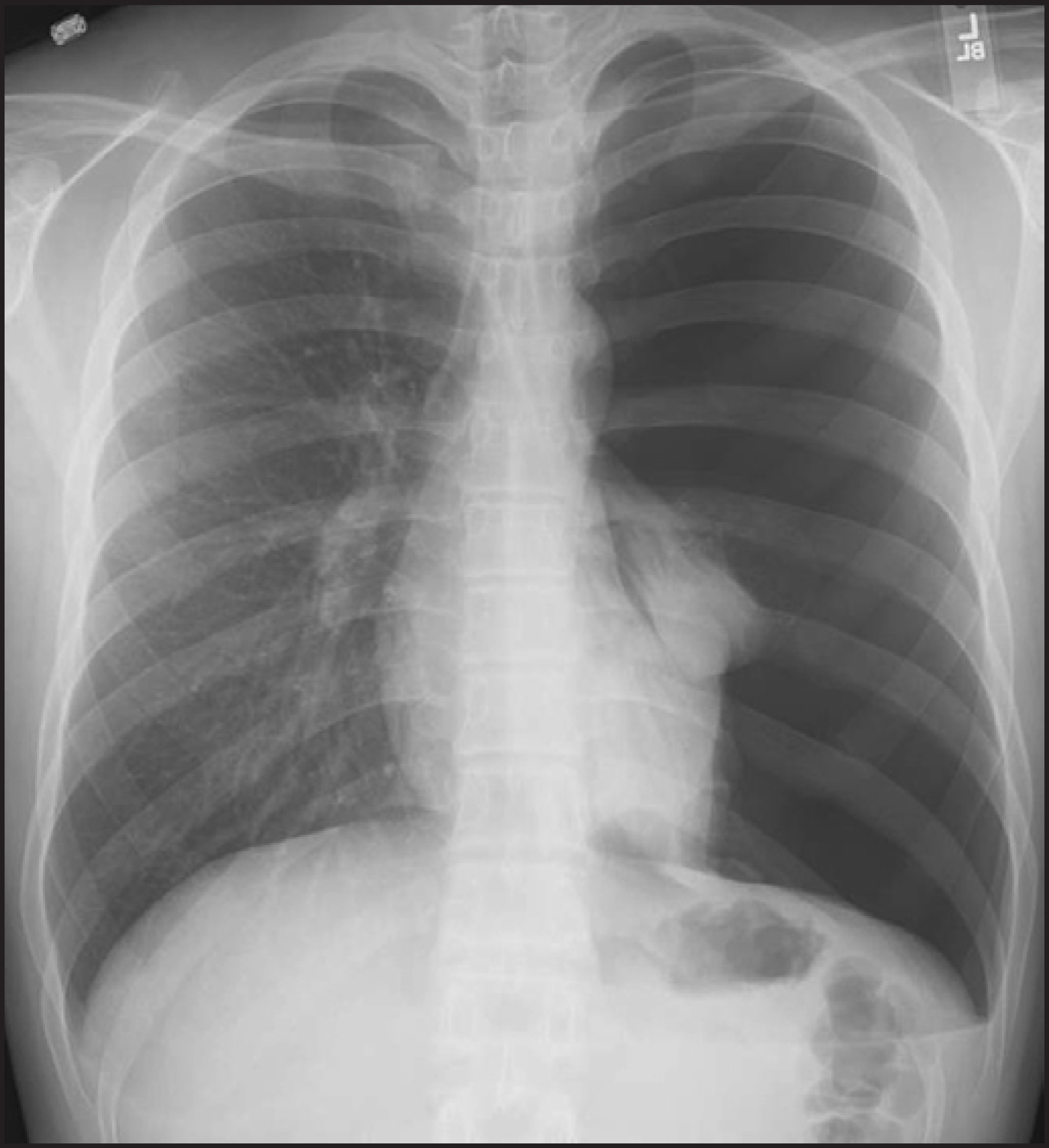 FIGURE 8.