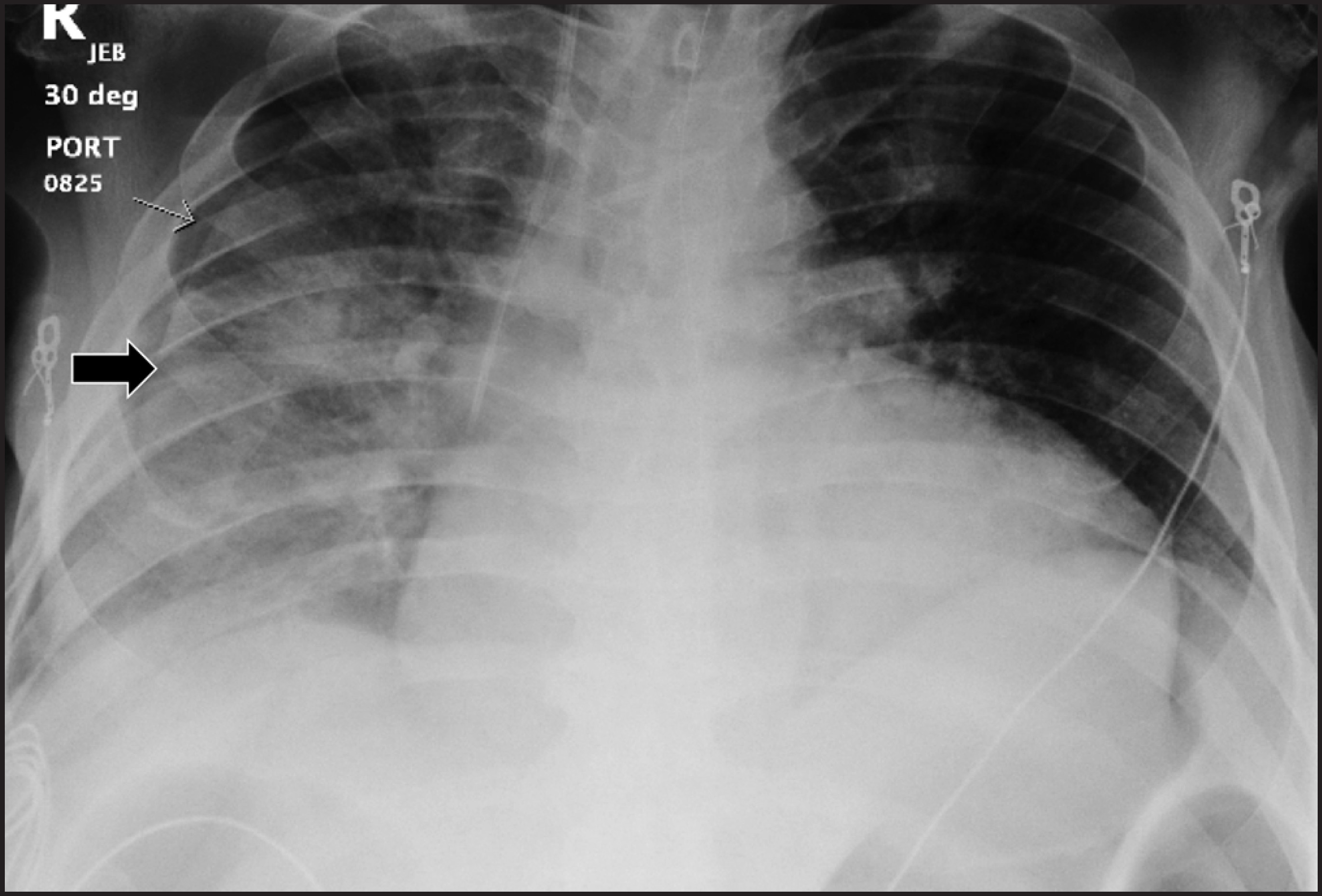 FIGURE 10.