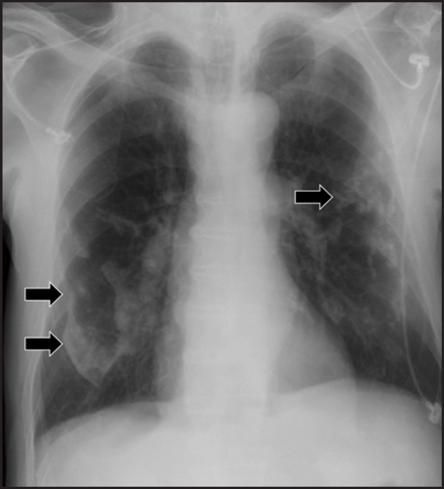 FIGURE 12.