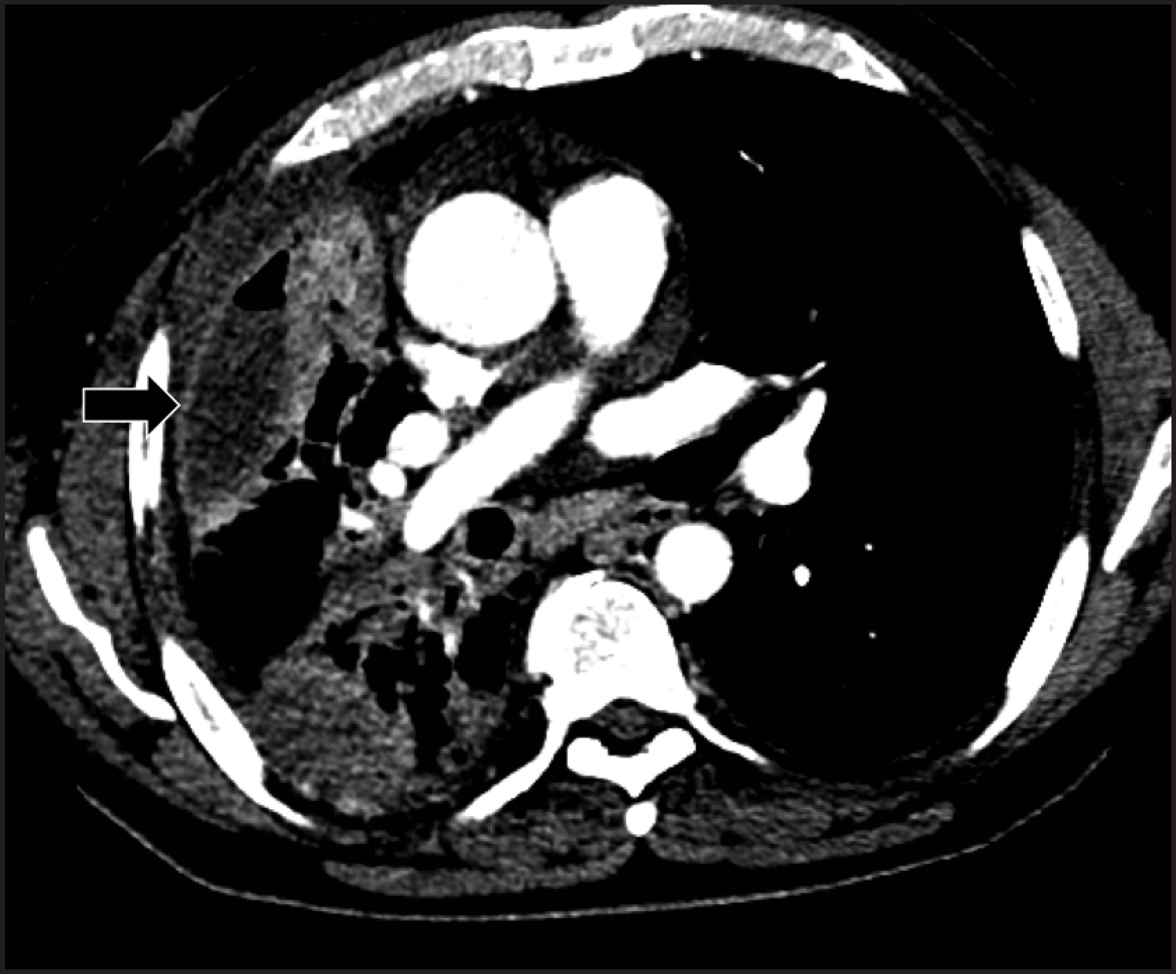 FIGURE 13.