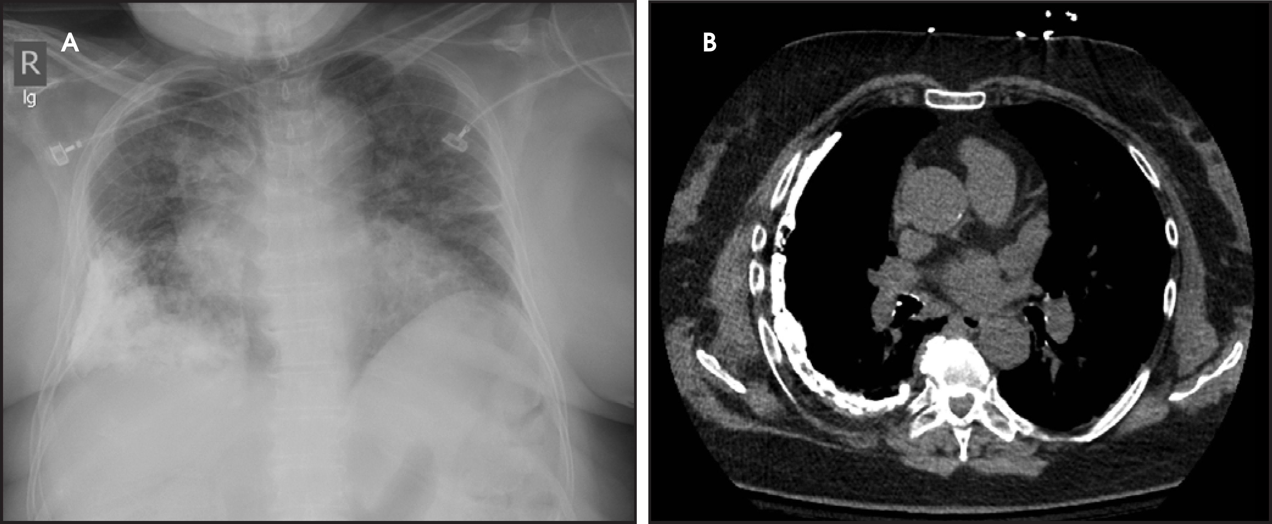 FIGURE 14.