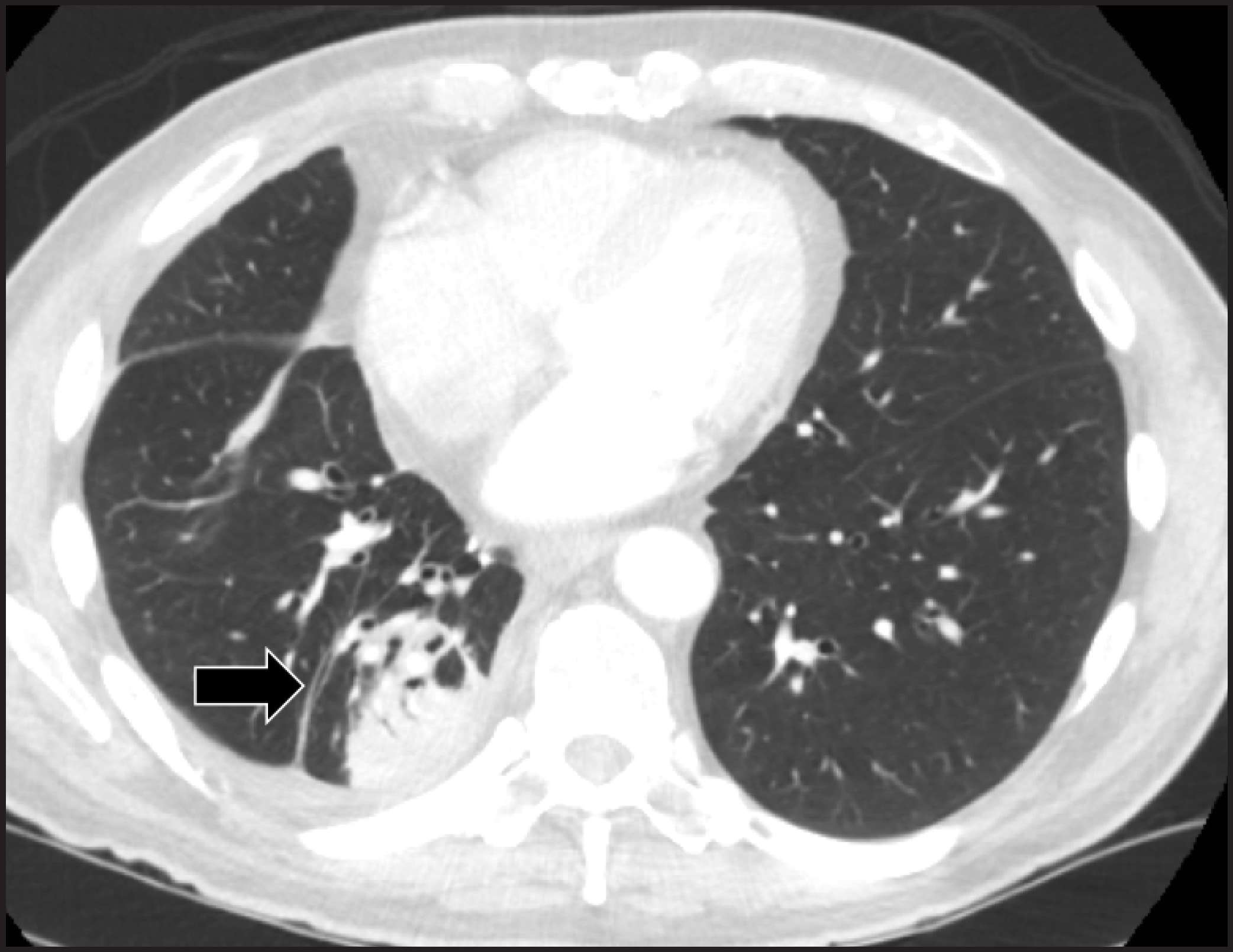 FIGURE 15.