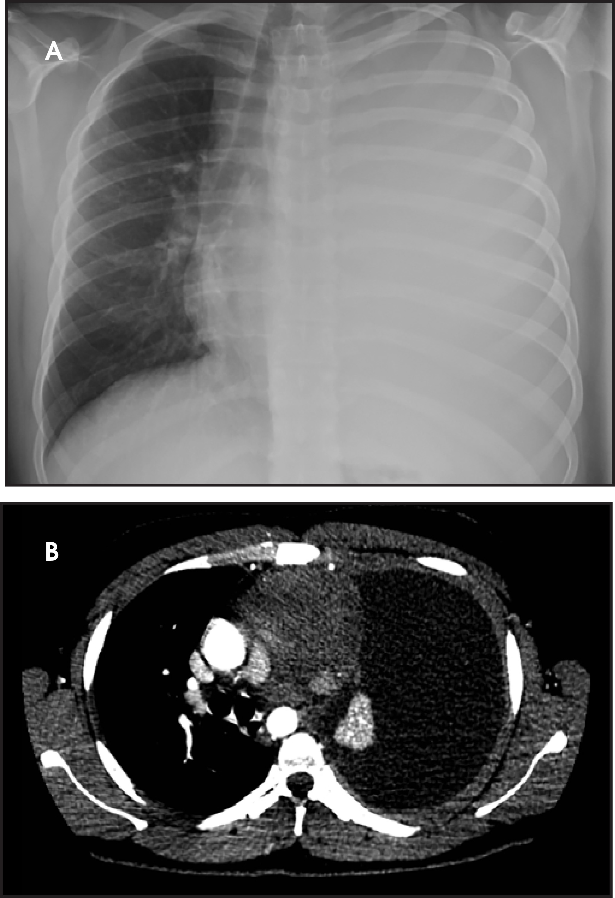 FIGURE 16.