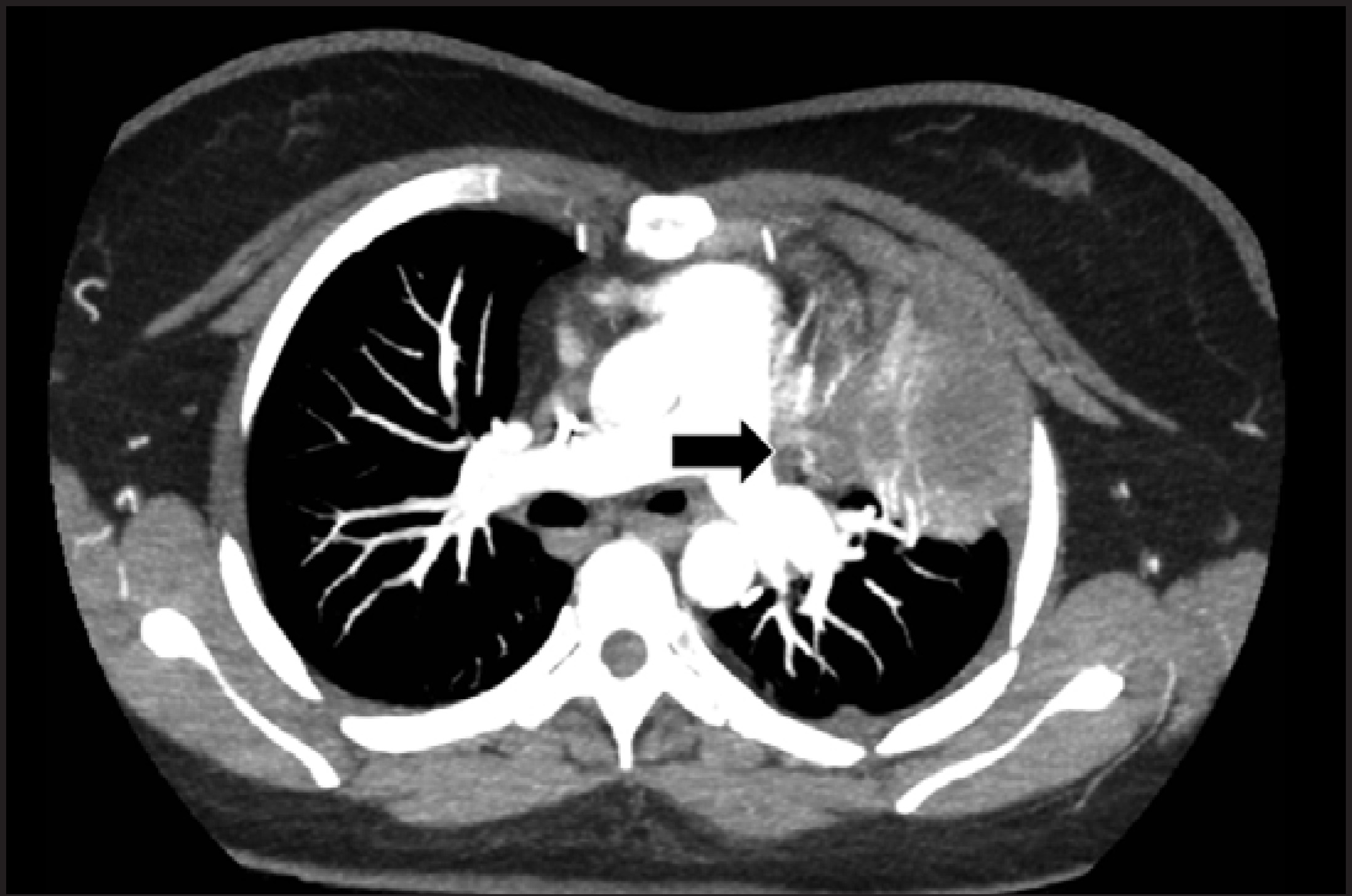 FIGURE 17.