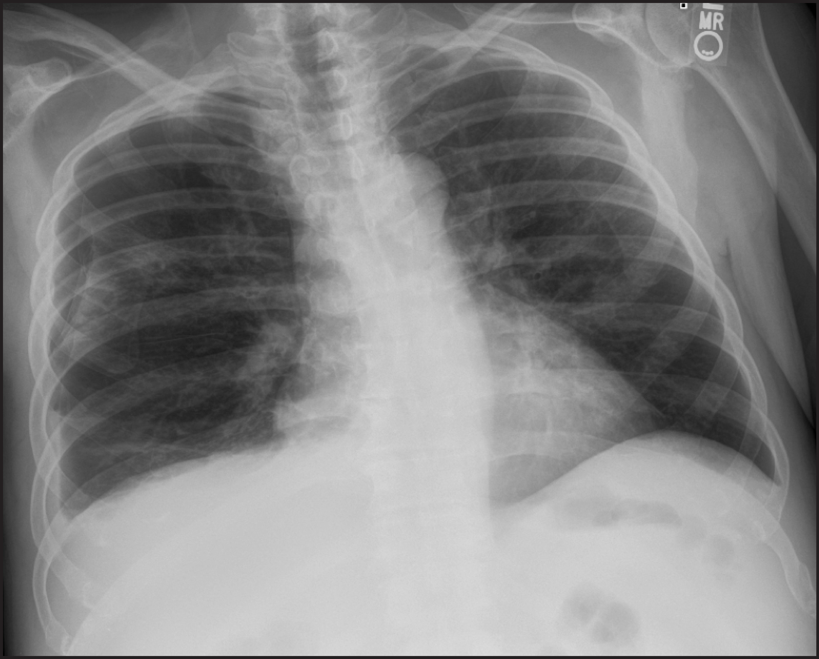 FIGURE 19.