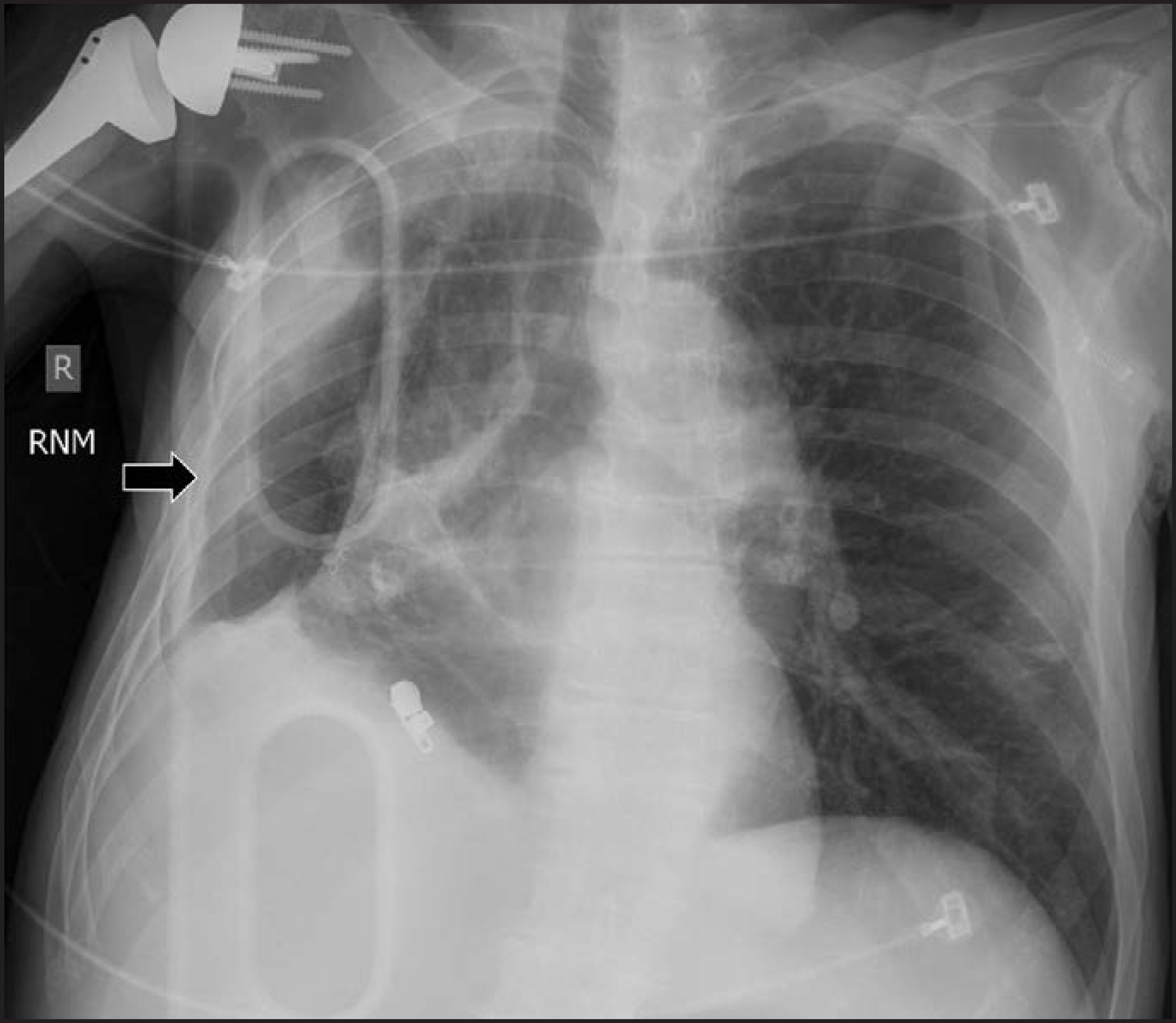 FIGURE 21.