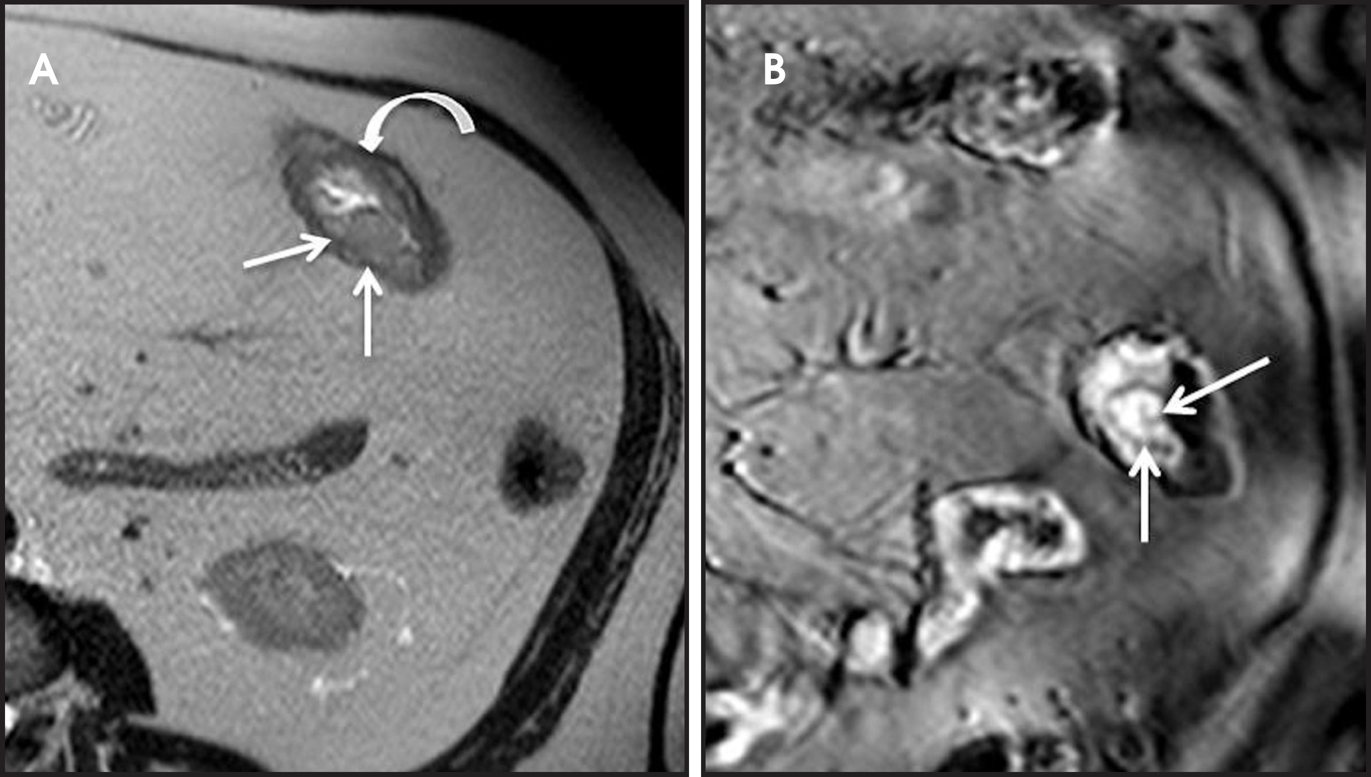 FIGURE 11.