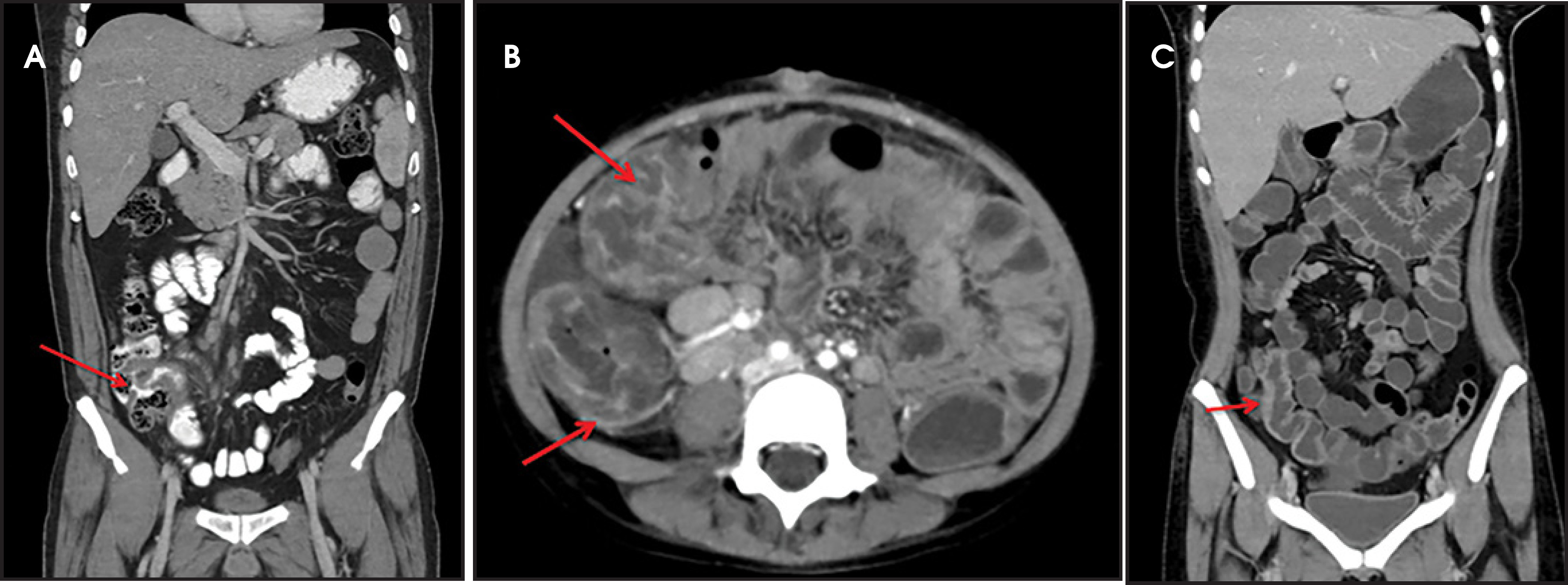 FIGURE 6.