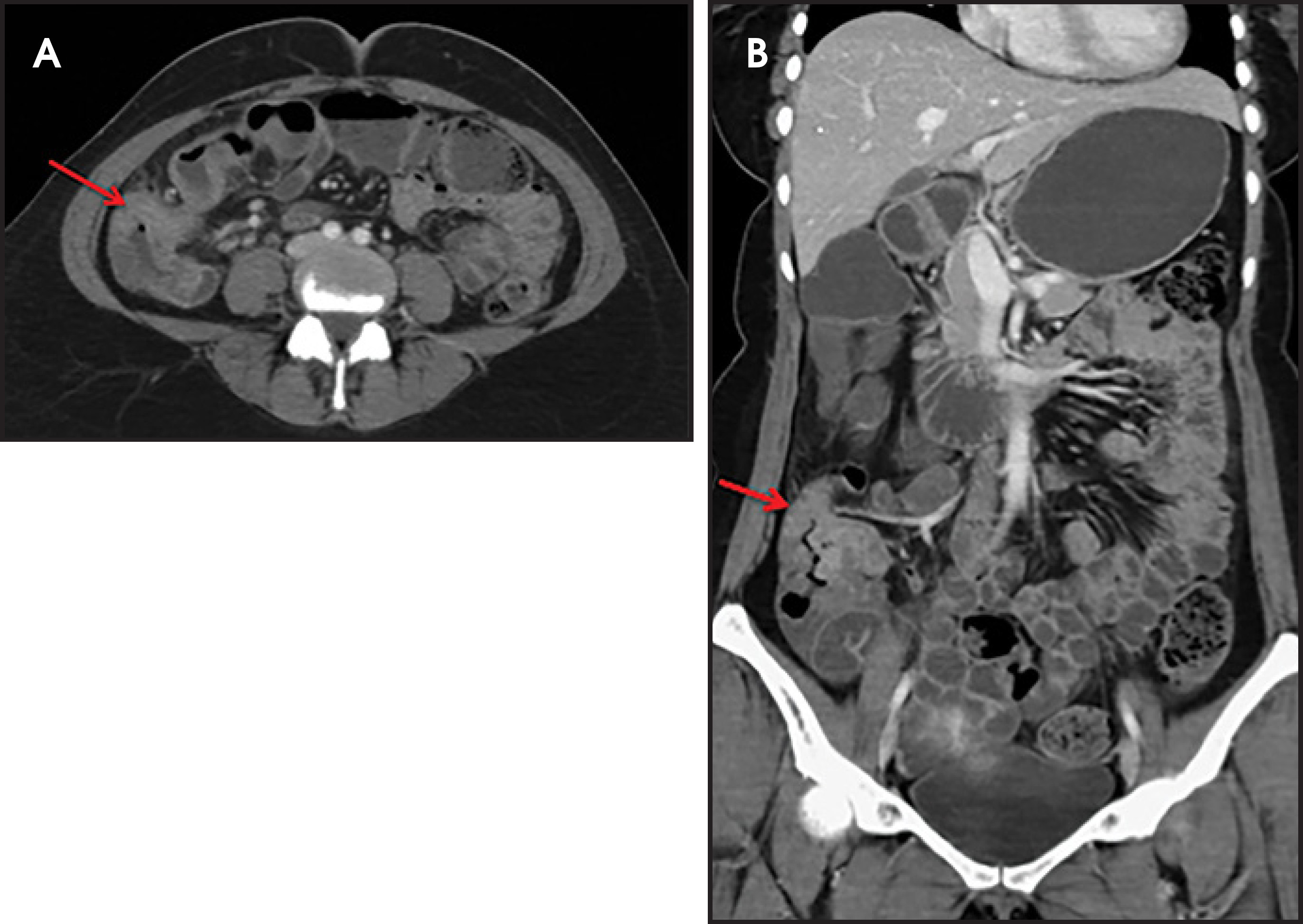 FIGURE 10.