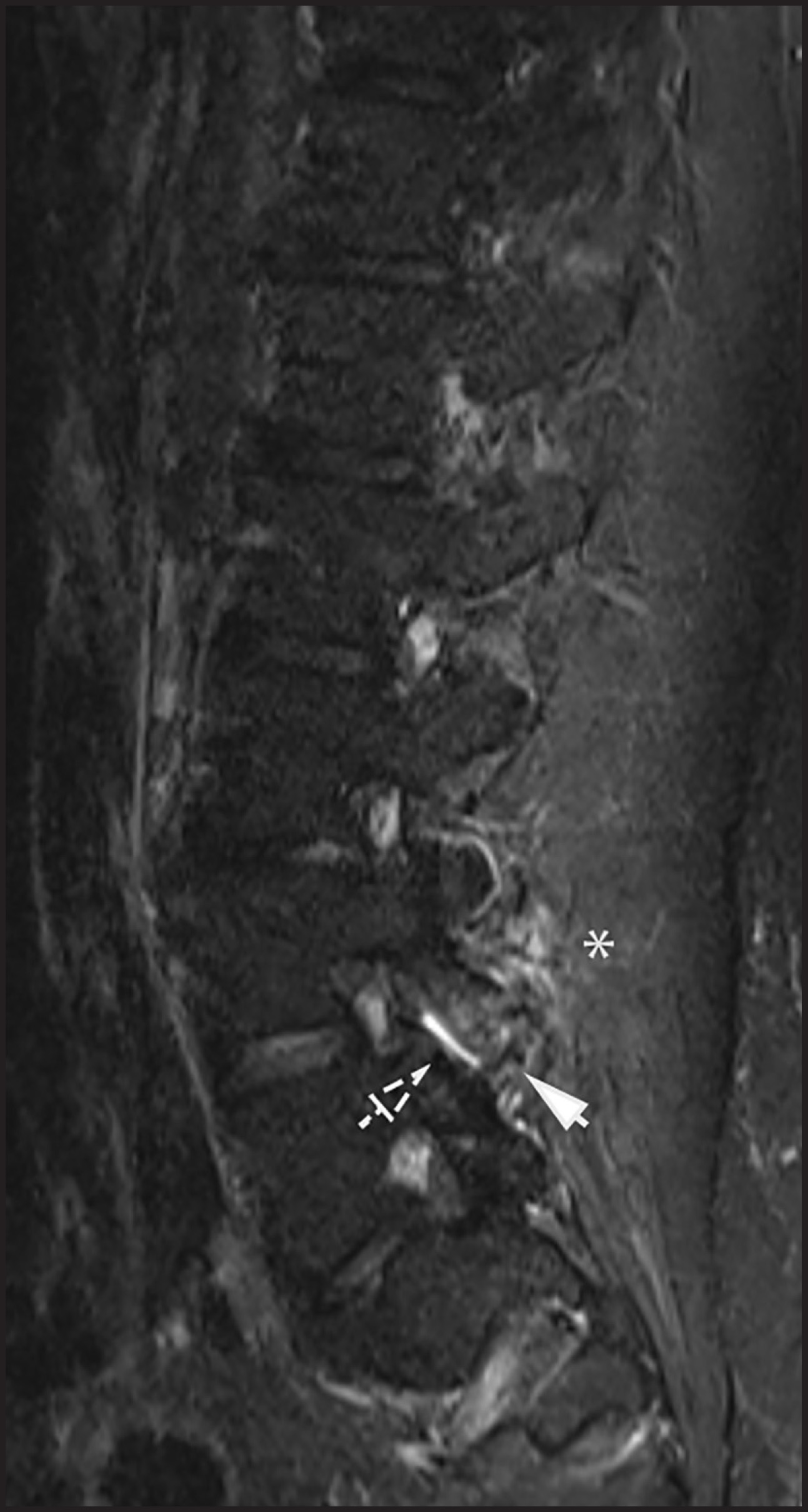 FIGURE 11.