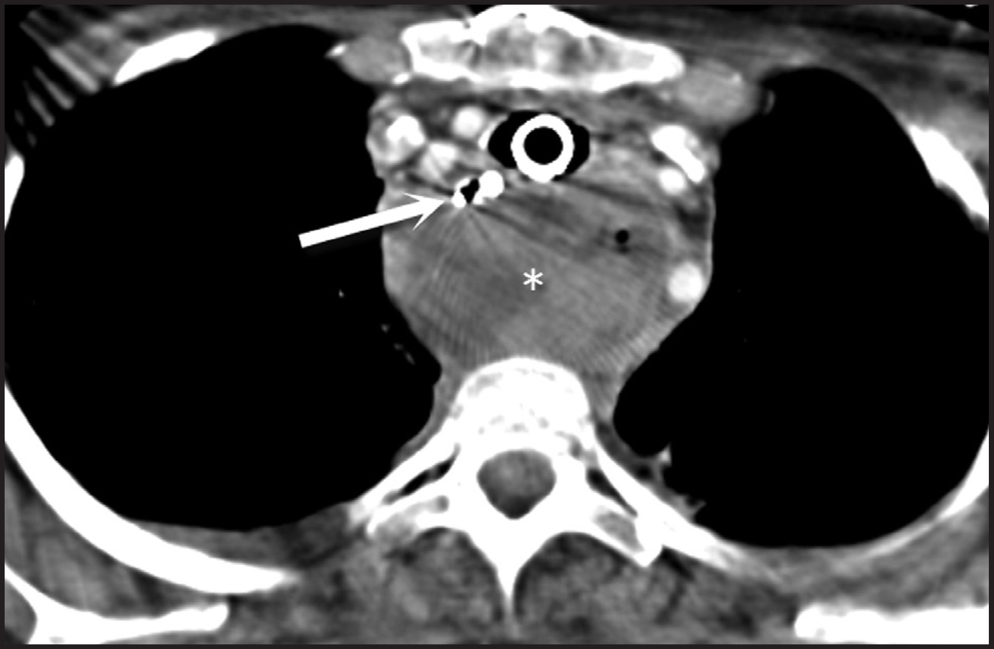 FIGURE 11.