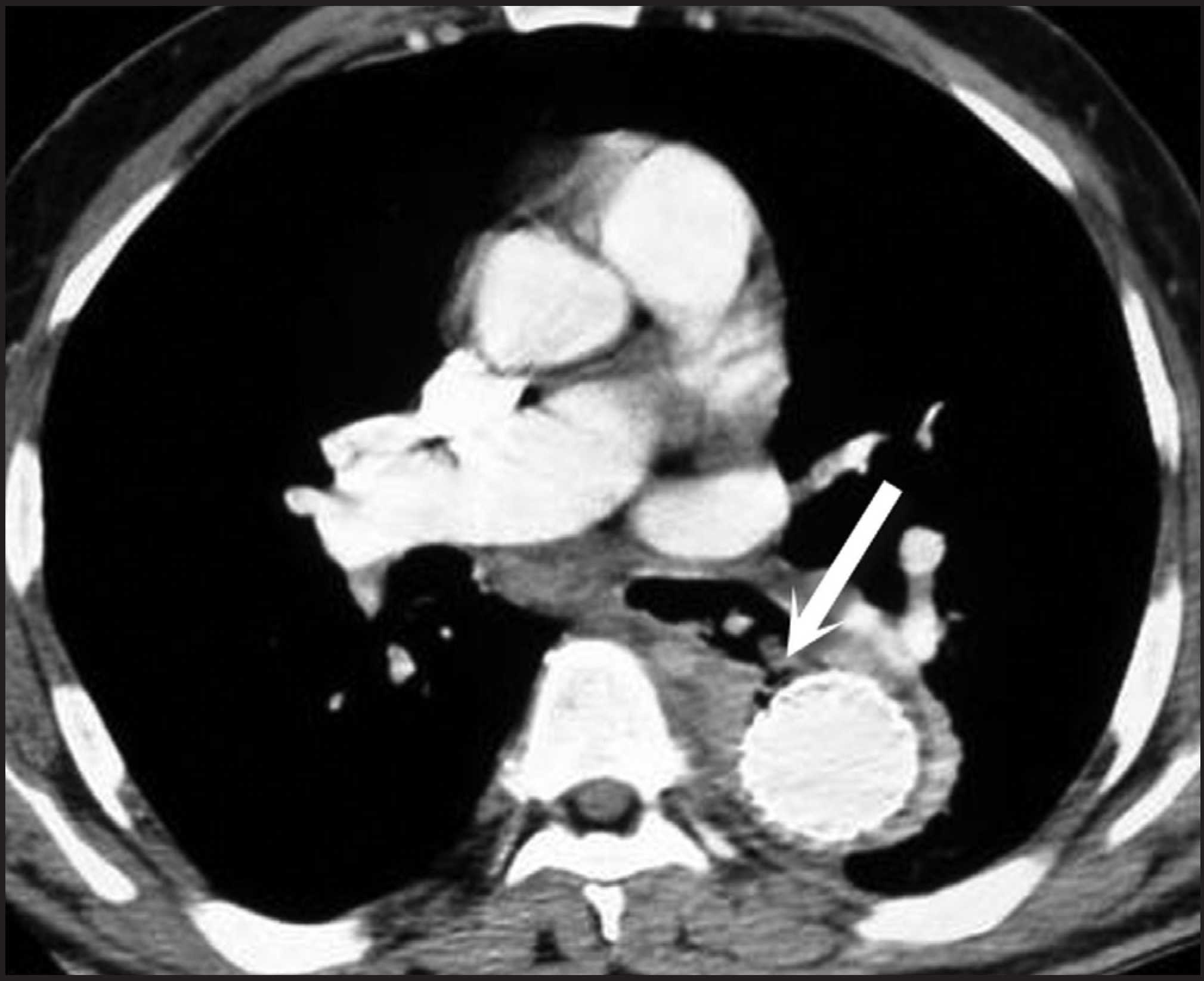FIGURE 13.