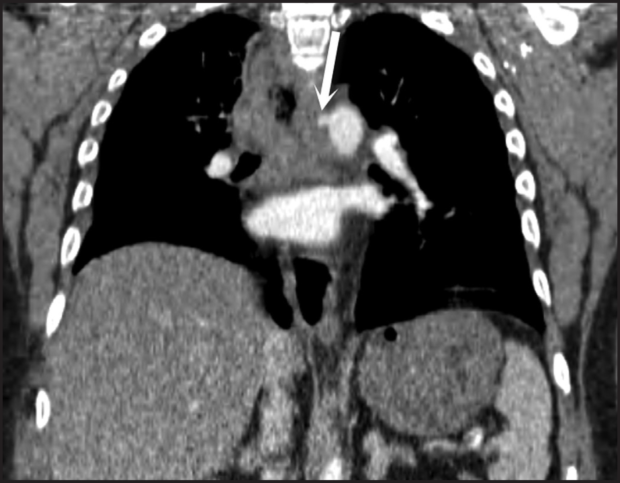 FIGURE 14.