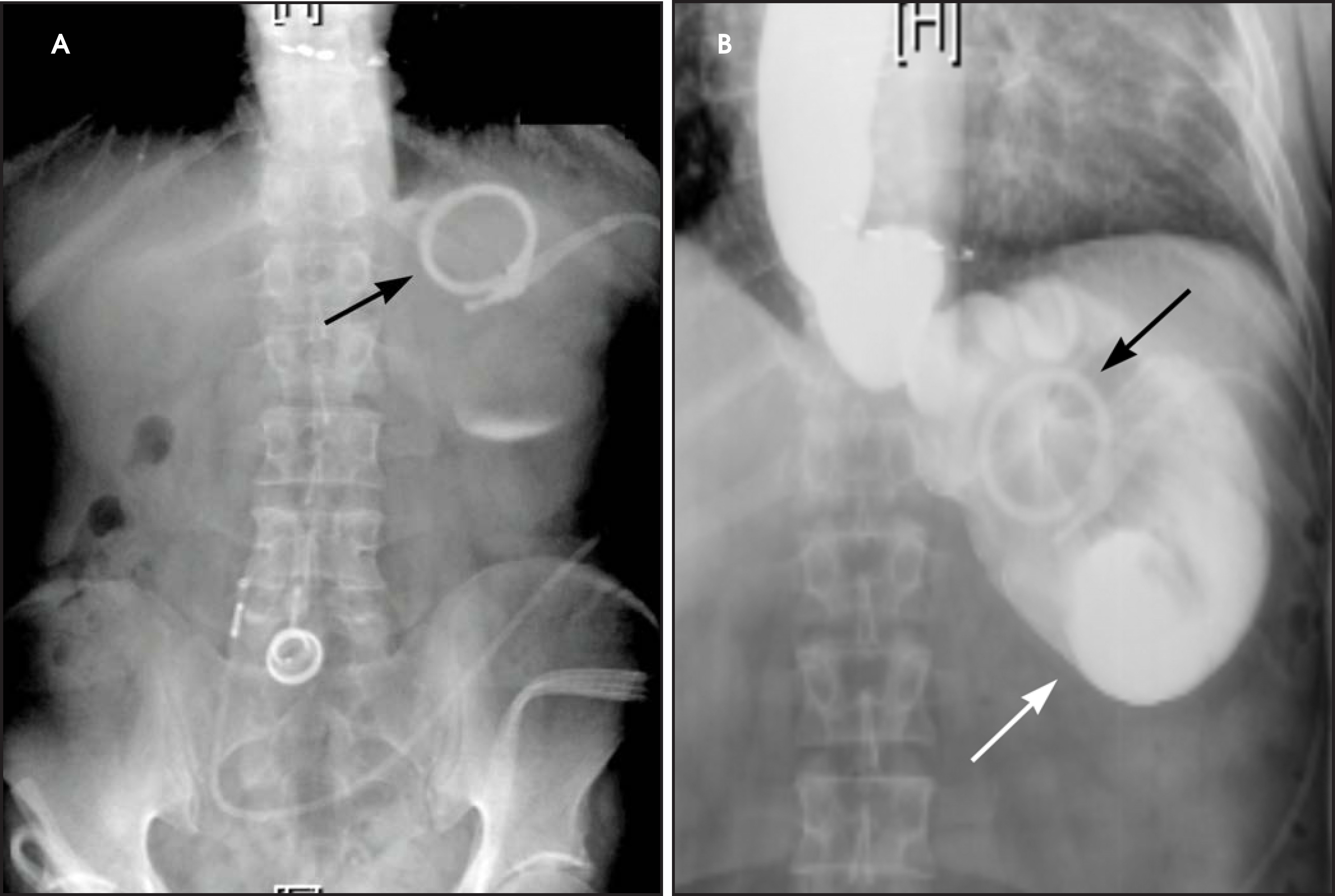 FIGURE 9.
