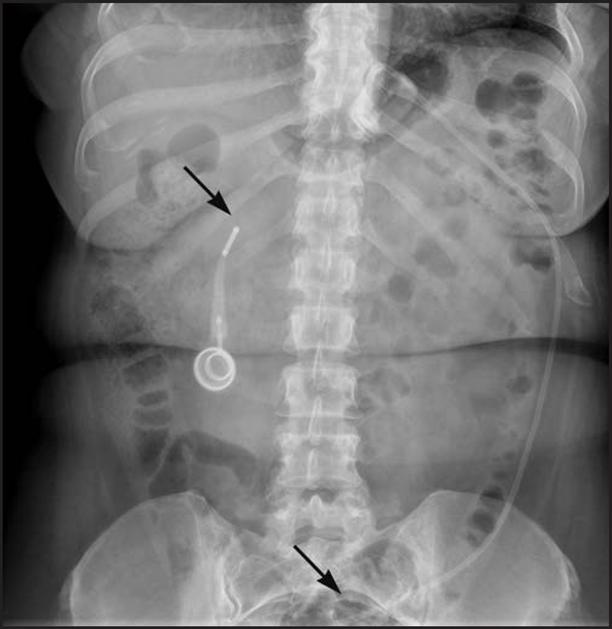 FIGURE 11.
