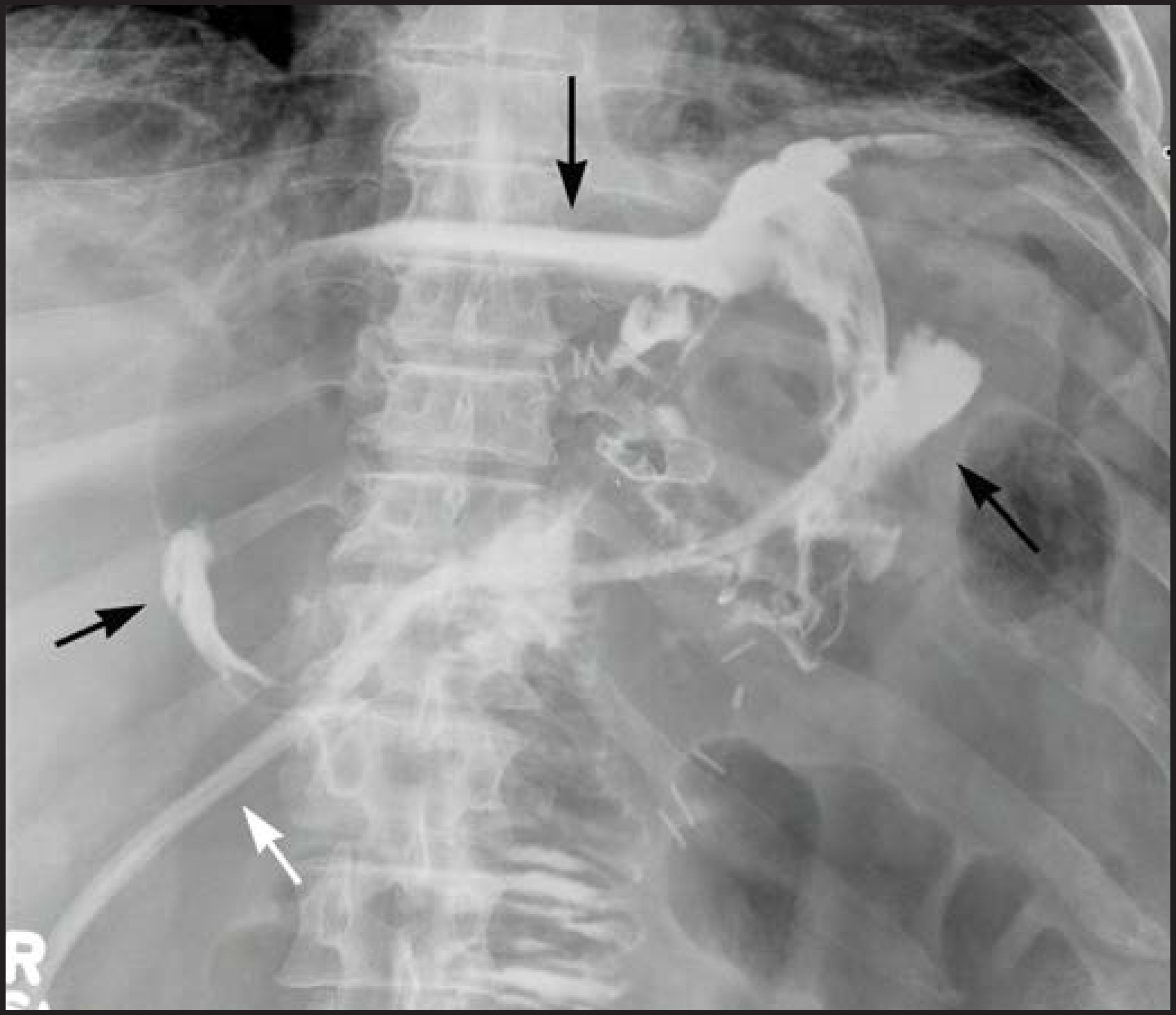 FIGURE 13.