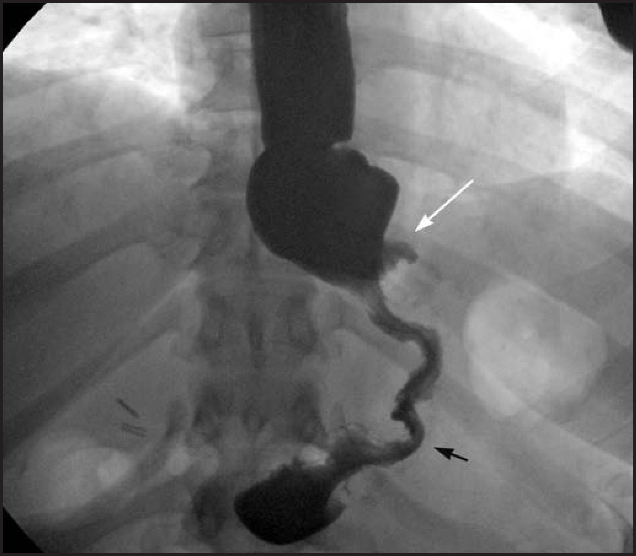 FIGURE 14.