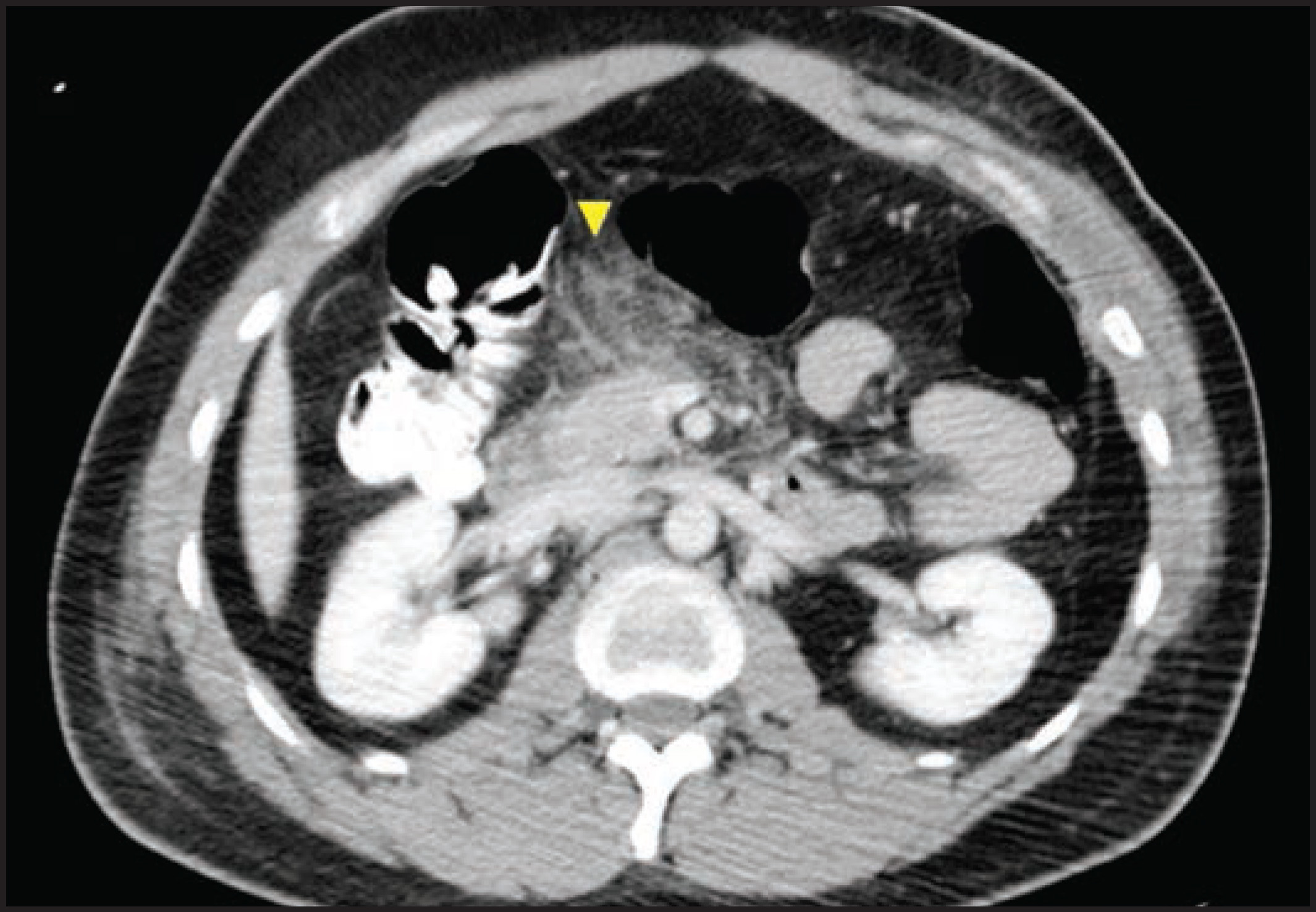 FIGURE 4.