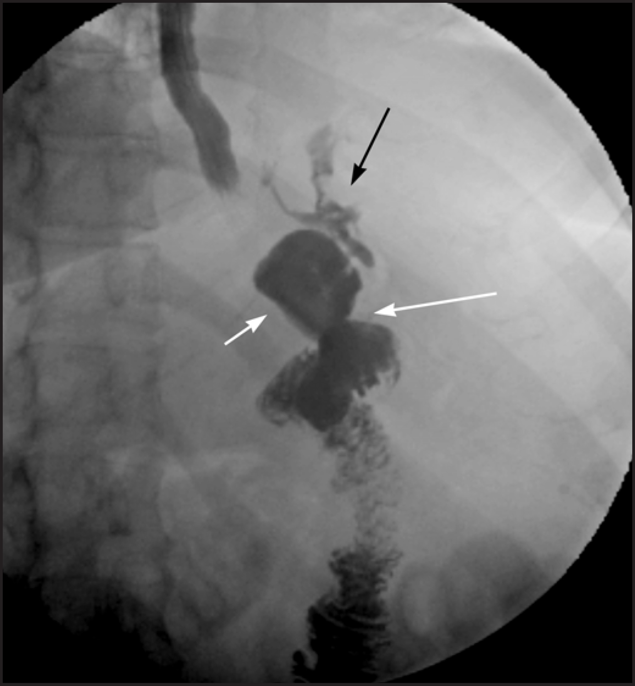 FIGURE 3.