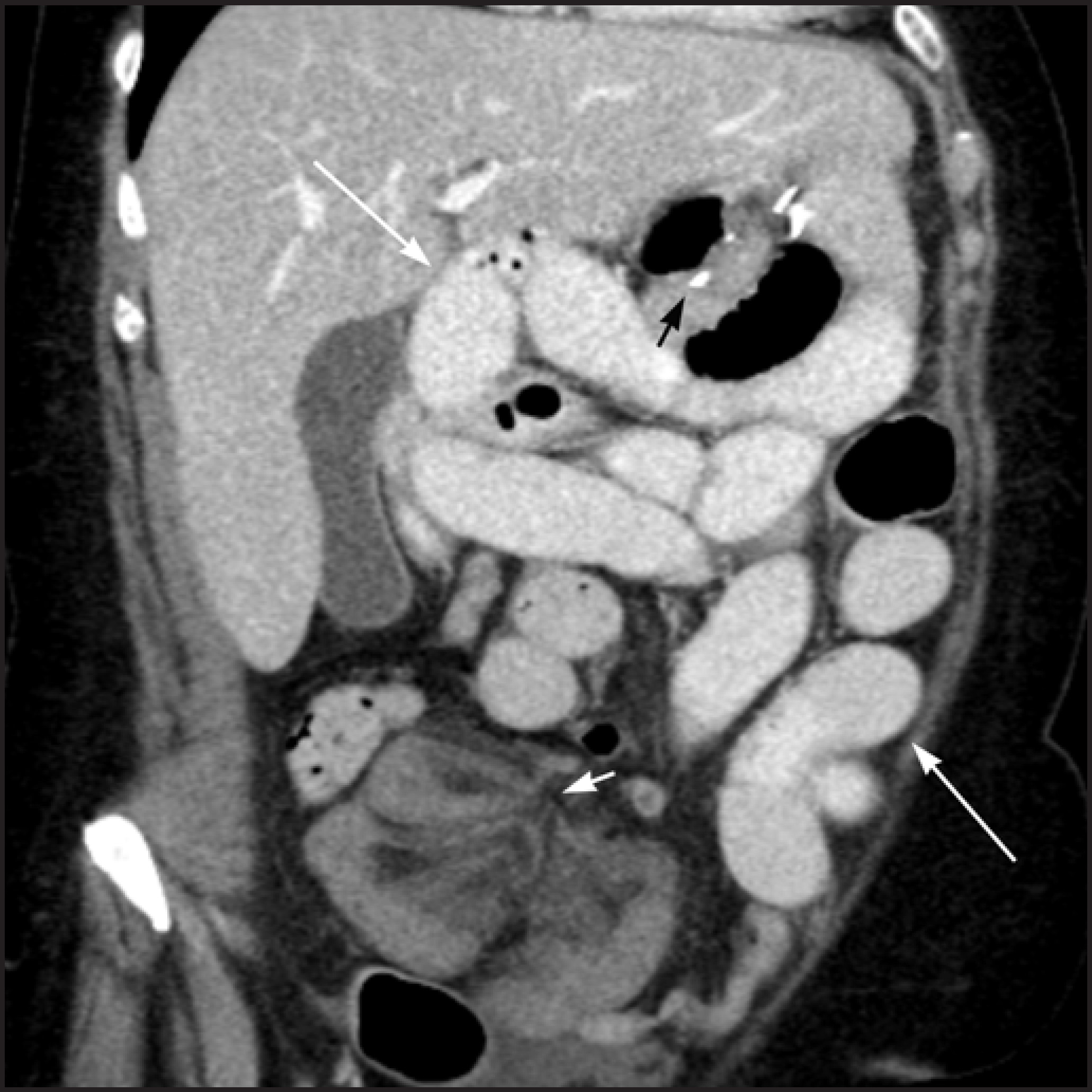 FIGURE 12.