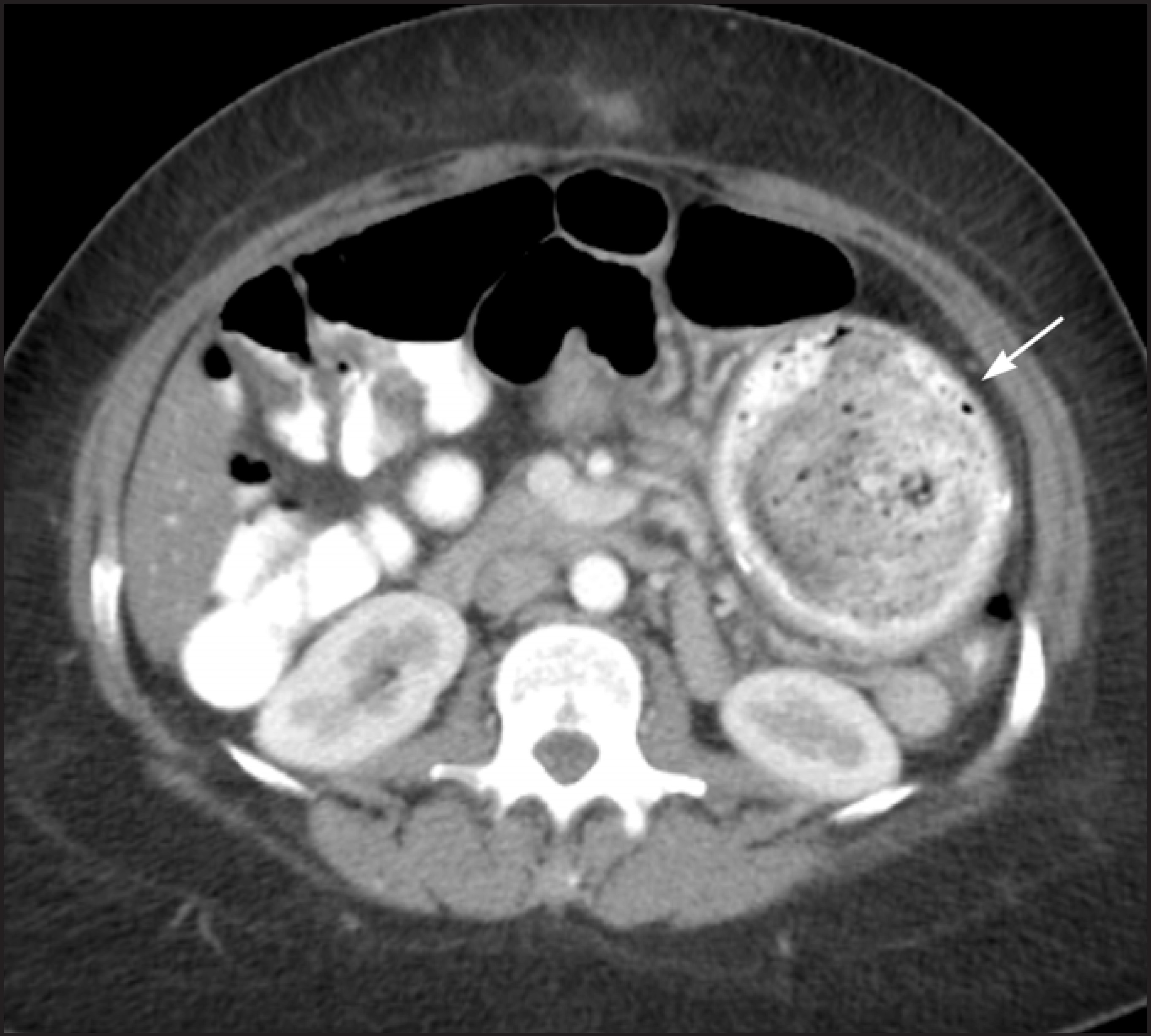FIGURE 15.