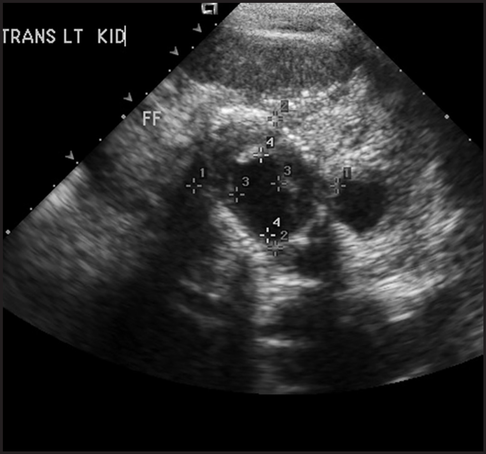 FIGURE 1.