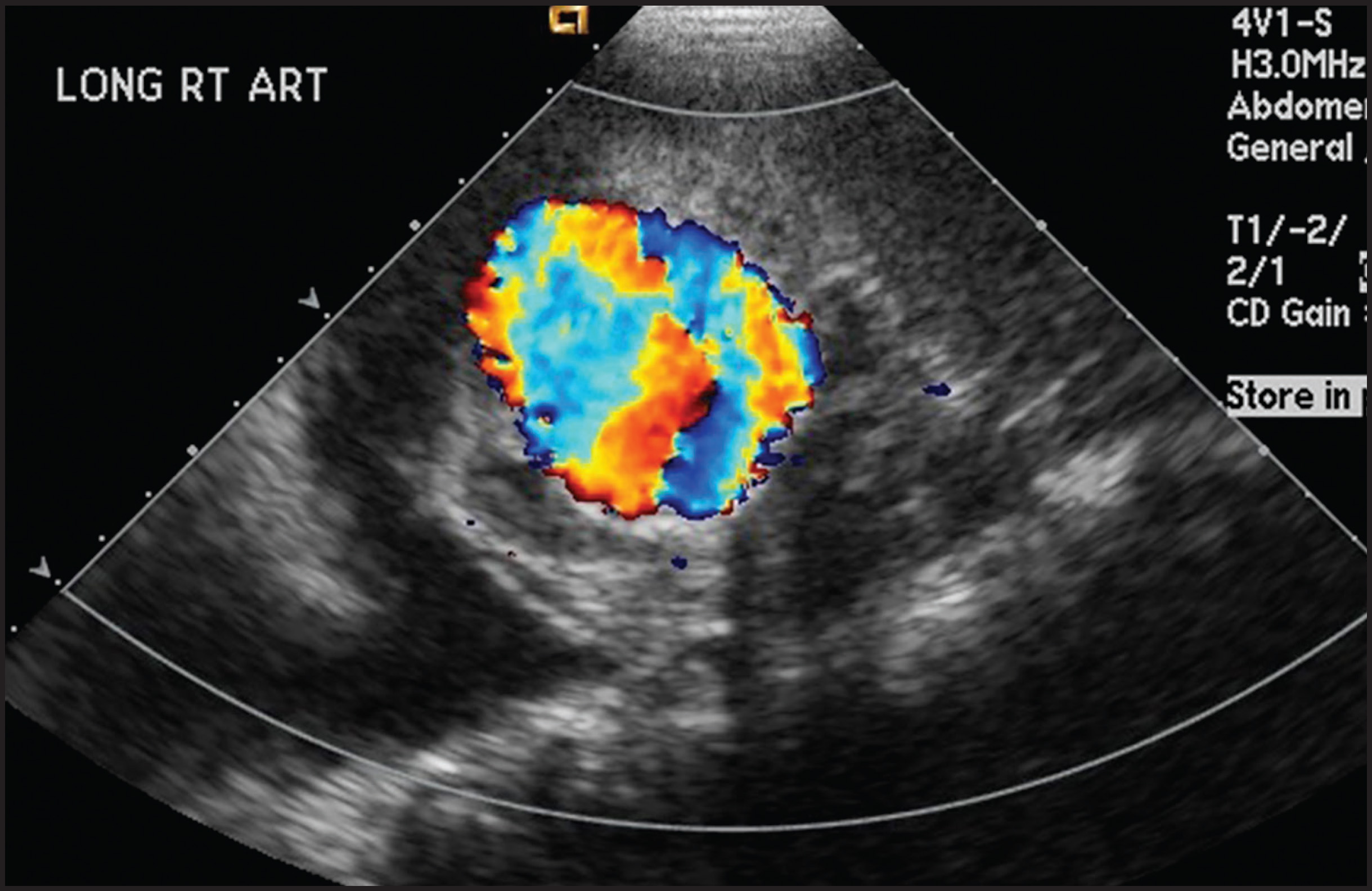 FIGURE 2.