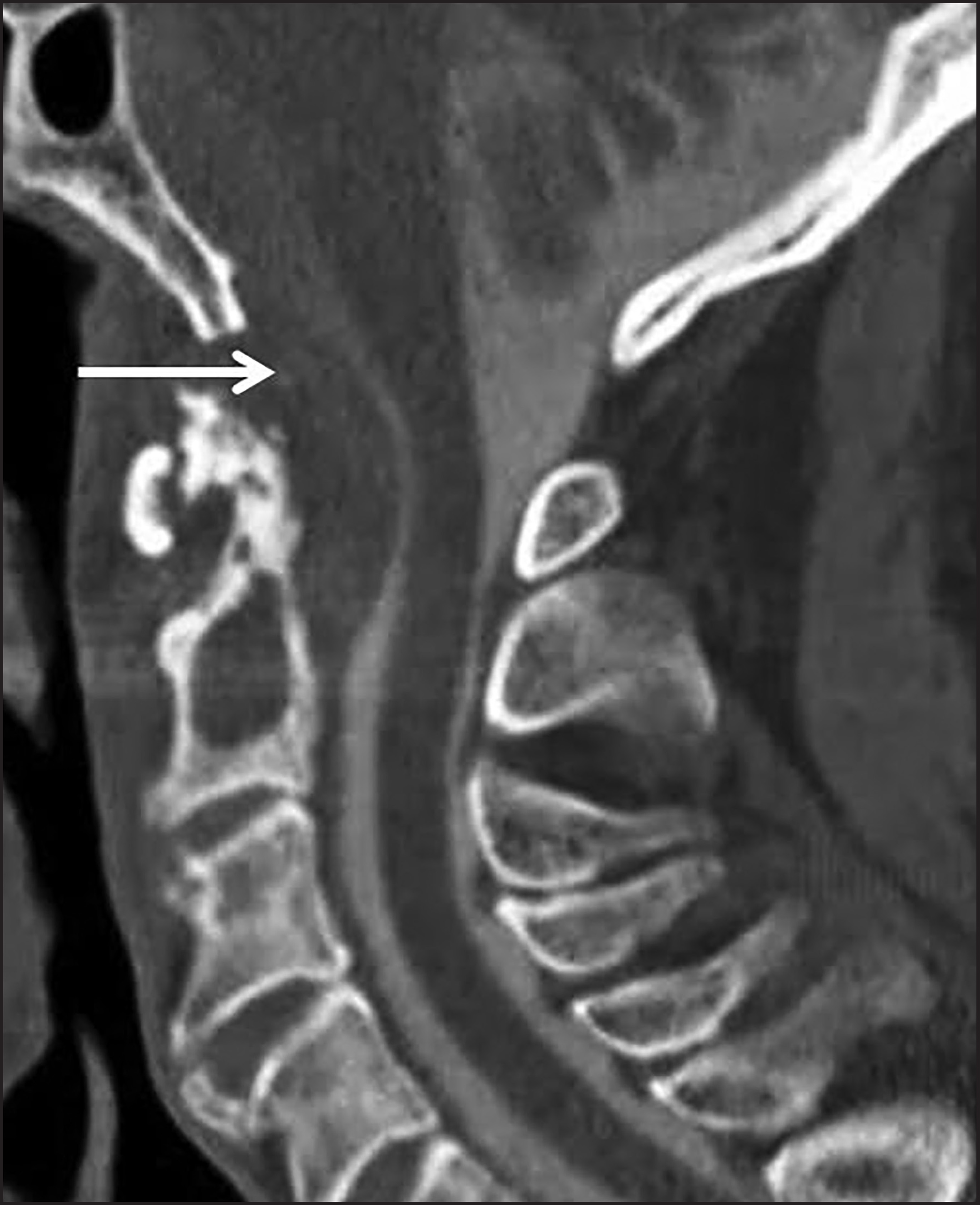 FIGURE 11.