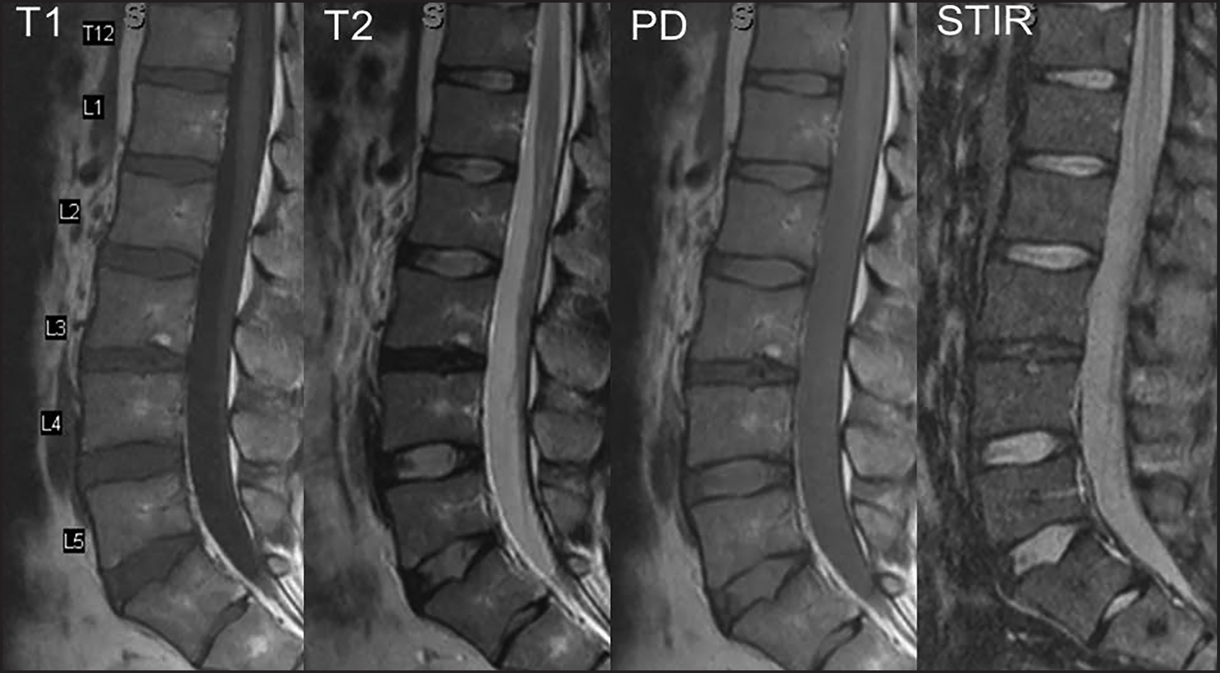 FIGURE 13.